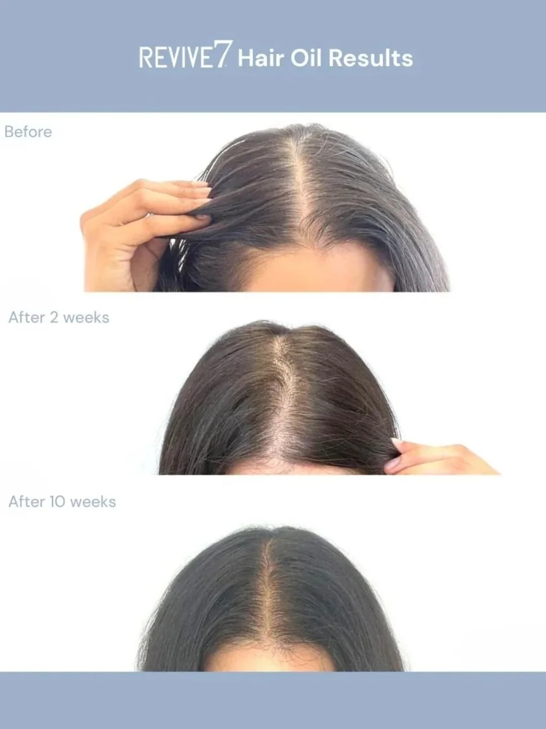 Huile Capillaire | Revive7