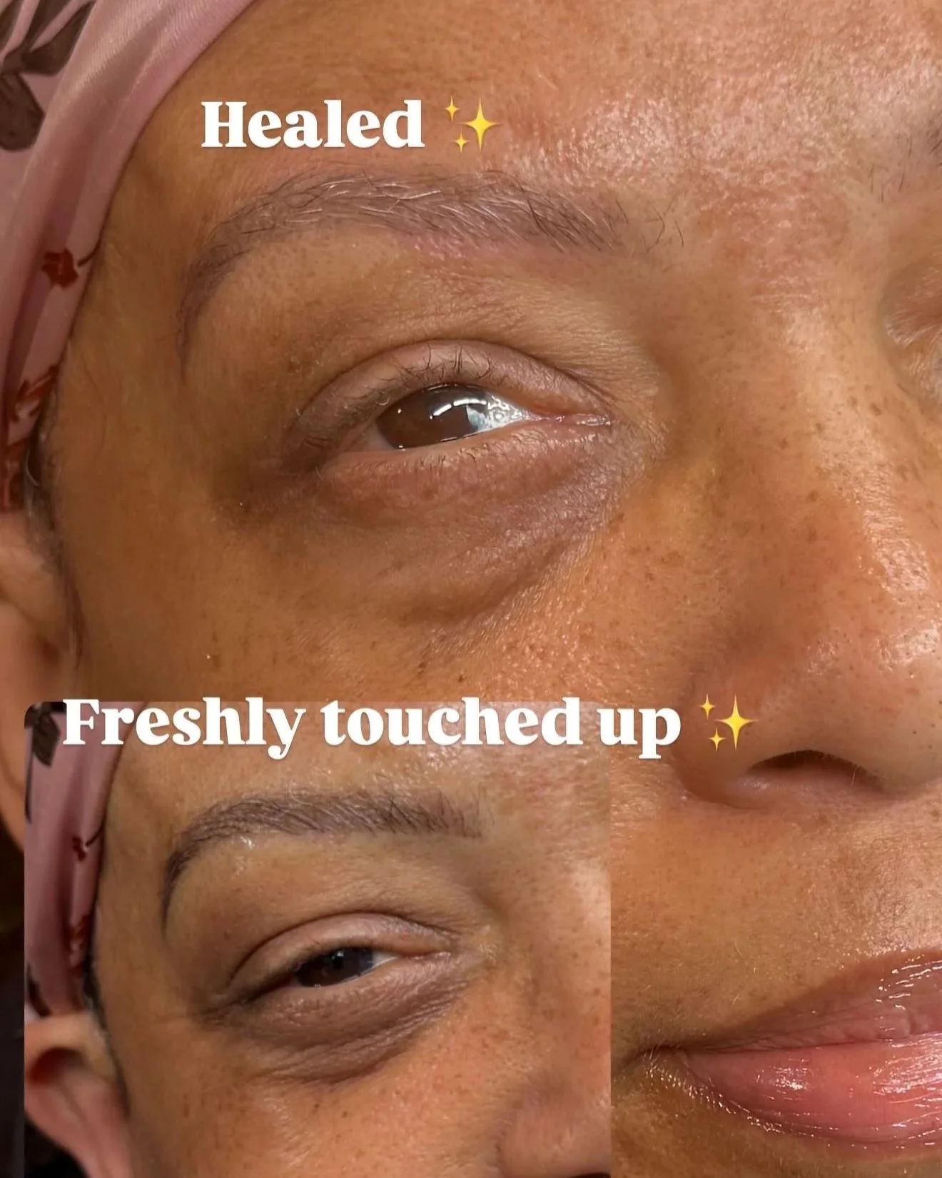 Close-up of a person's eye area showing before and after Permanent Makeup. Powder Brows. Nano strokes.