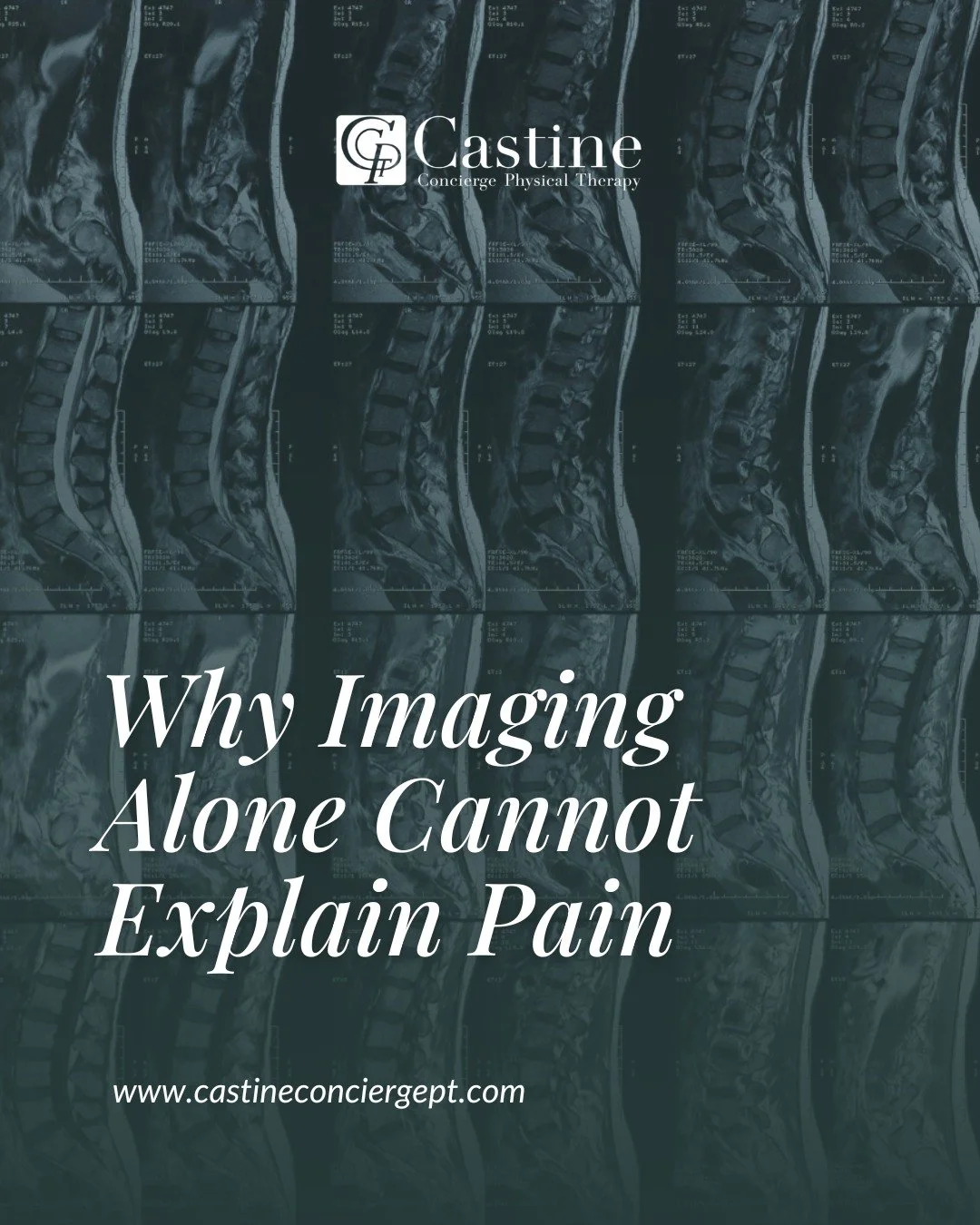 Large systematic reviews led by Brinjikji and colleagues examined spinal imaging findings in people without pain and found that many commonly labeled &ldquo;abnormalities&rdquo; are extremely prevalent in asymptomatic individuals.

Key findings inclu
