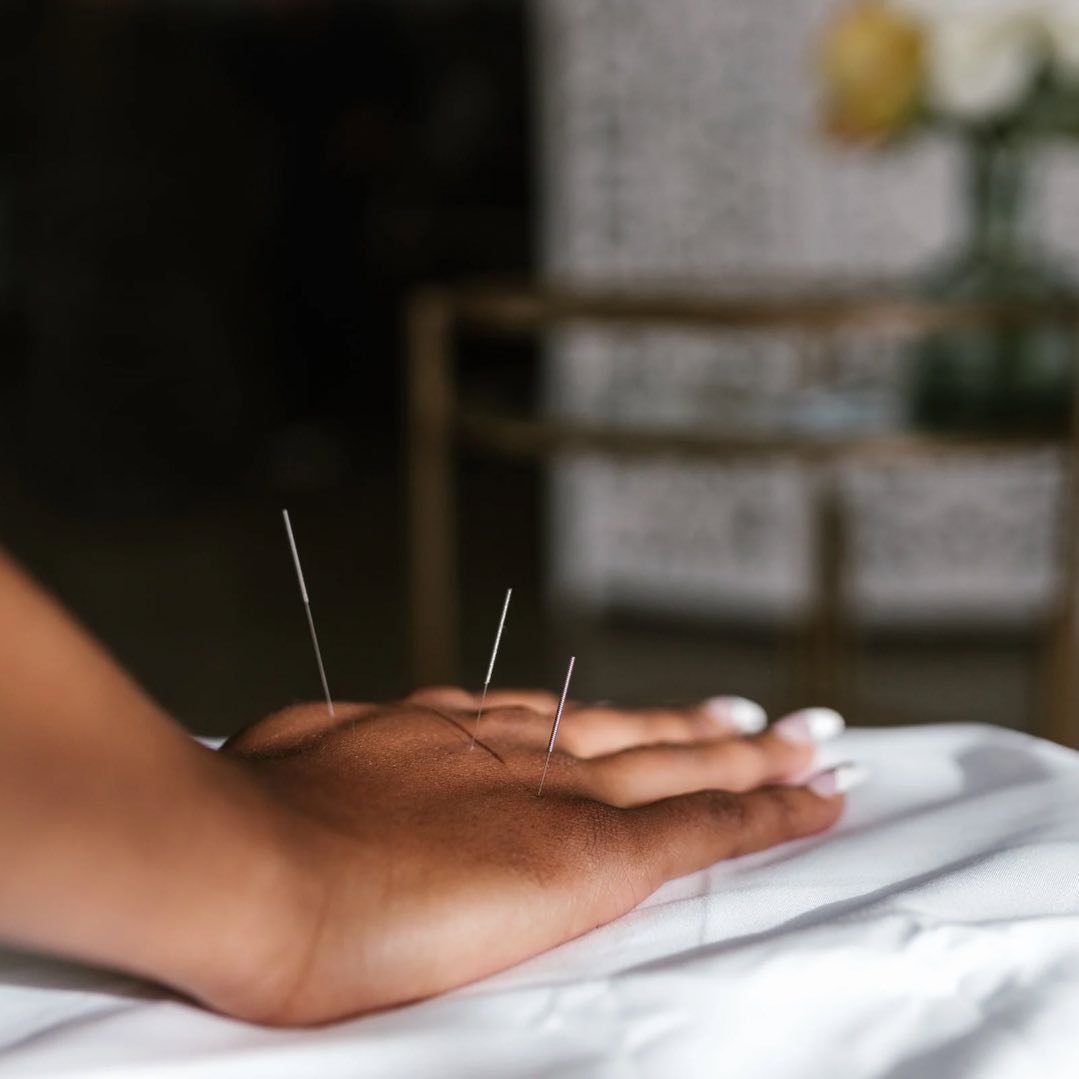 Acupuncture is a very special mixture of points selected just for you. In our upcoming yogapuncture class you will be receiving points that nourish our liver and digestive system. #yogapuncture #liver #acupuncture #tcm