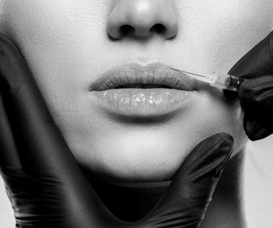 Skin Eleve black-and-white close-up of a lip filler injection at the corner of the mouth