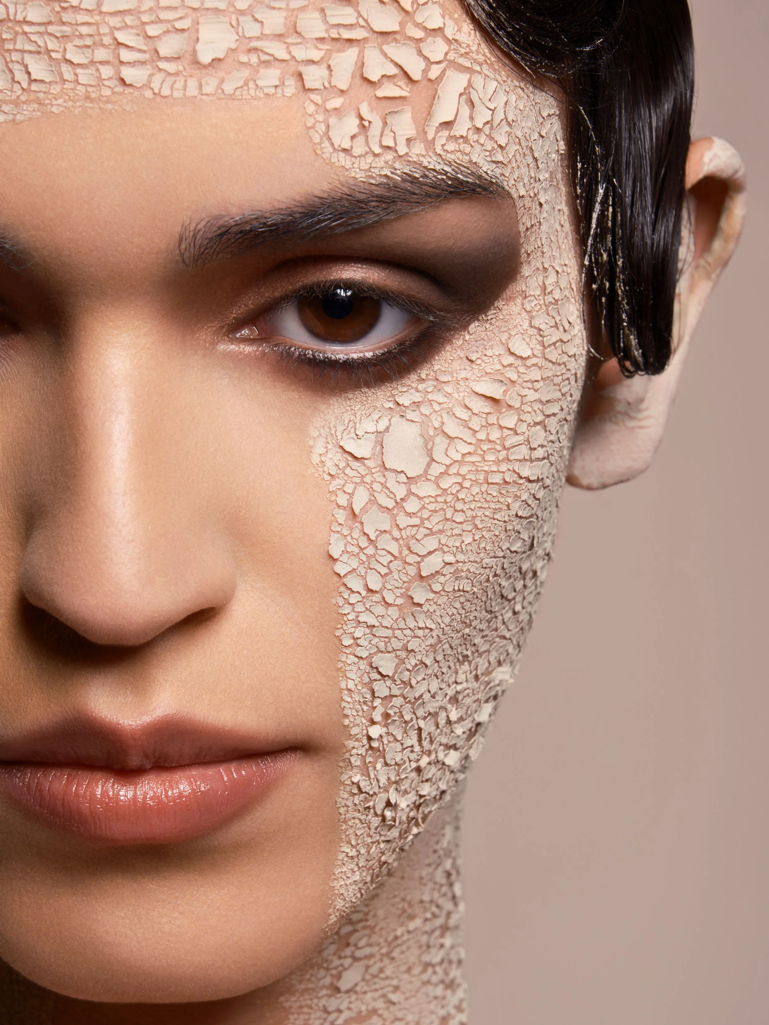 Close-up of a woman's face with peeling skin on the right side, revealing dry, cracked skin beneath.