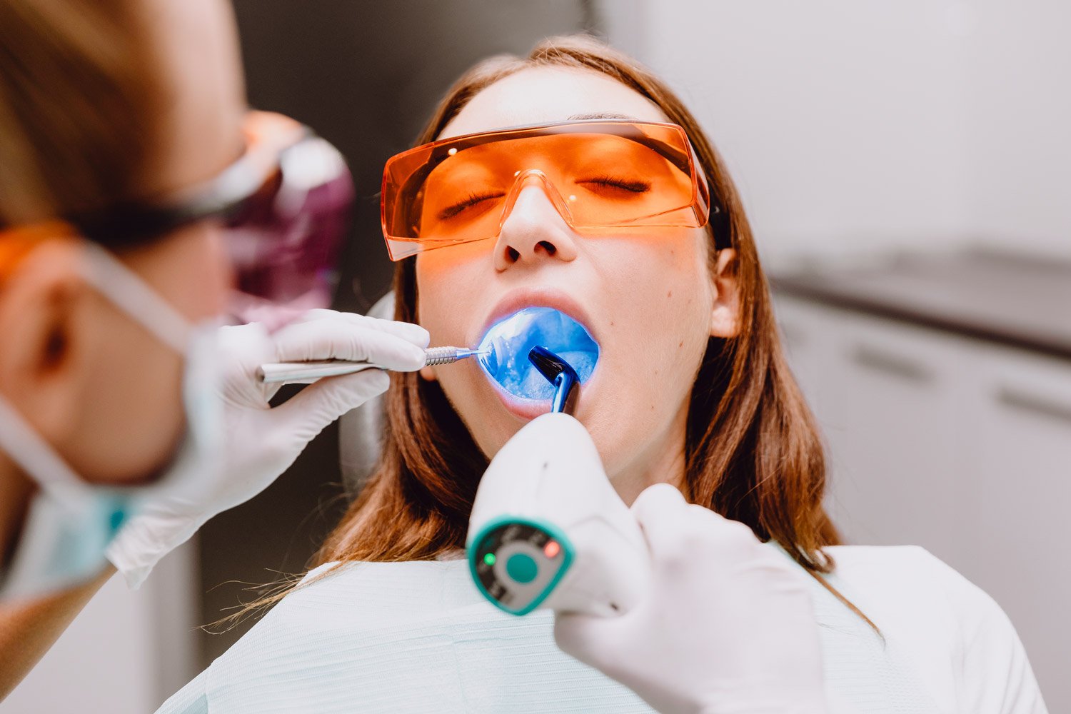 Zähne Bleaching einer Frau in Muenchen