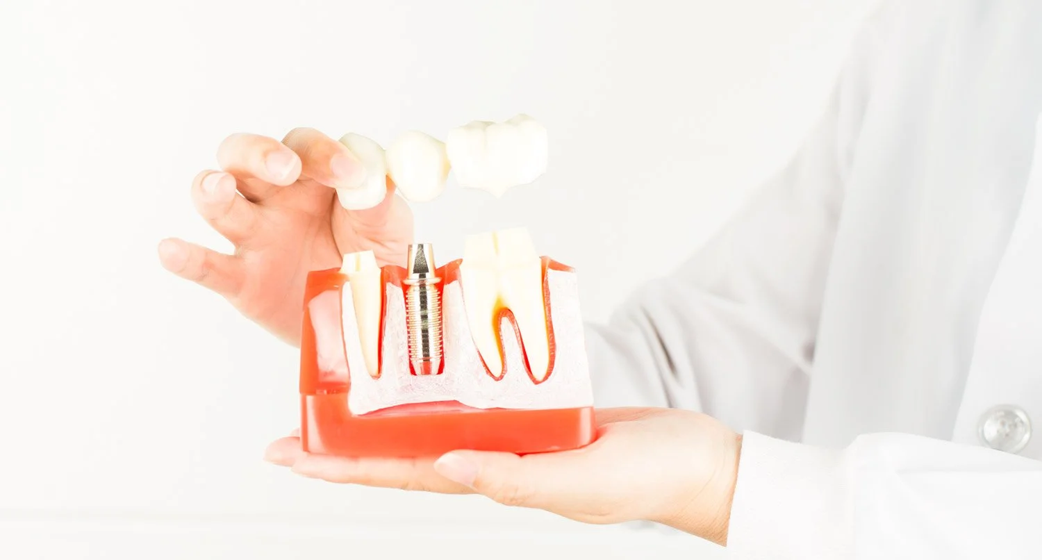 Innovation: CEREC Kronen in nur einem Termin