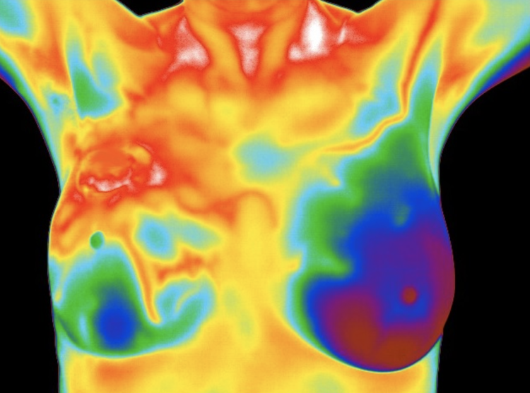 Thermal imaging at Live In Vitality Wellness Center in Brandon, Florida