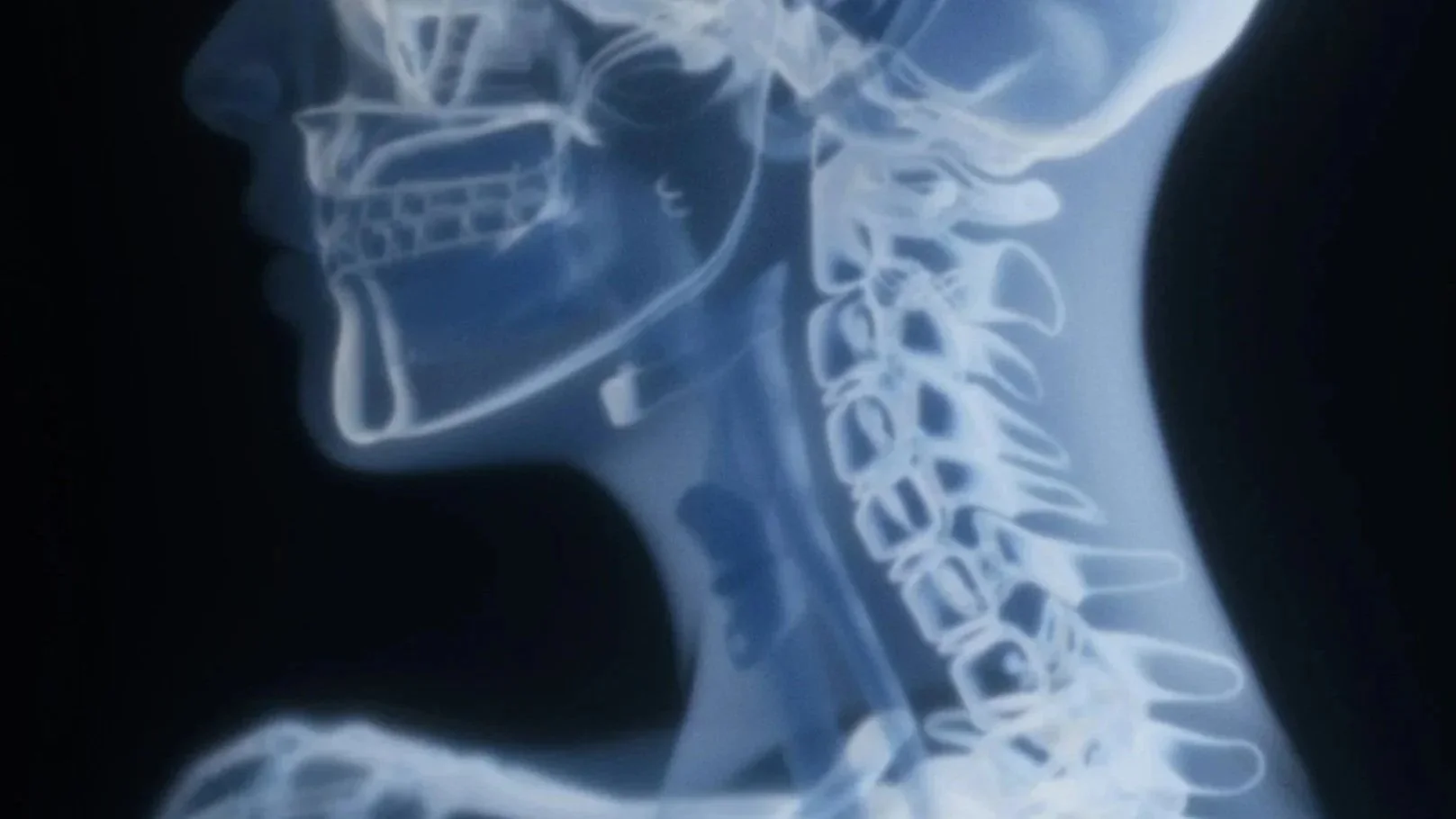 Why Your Headache Might Be Coming From Your Neck