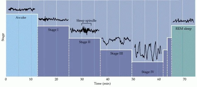 A graph depicting the stages of sleep and typical brainwaves associated with each, including REM sleep where most dreams occur.