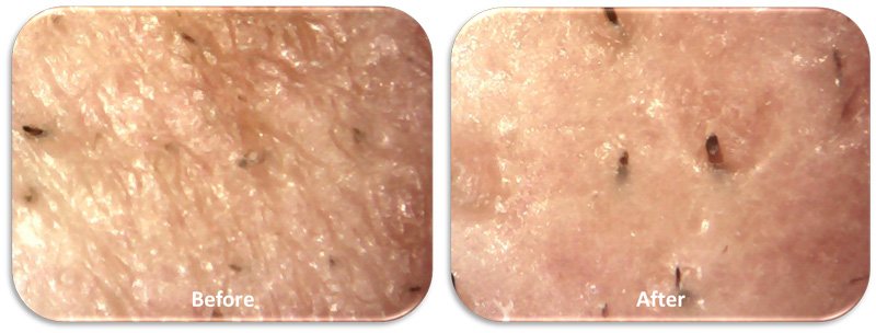 before-and-after-oxygeneo-5.jpg