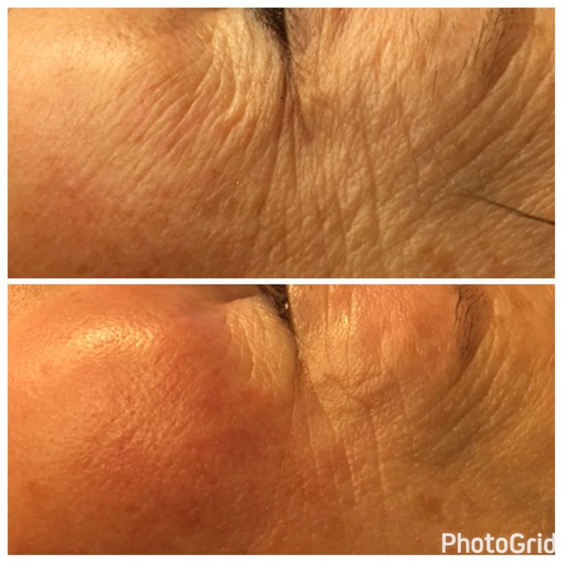 before-and-after-oxygeneo-9.jpg