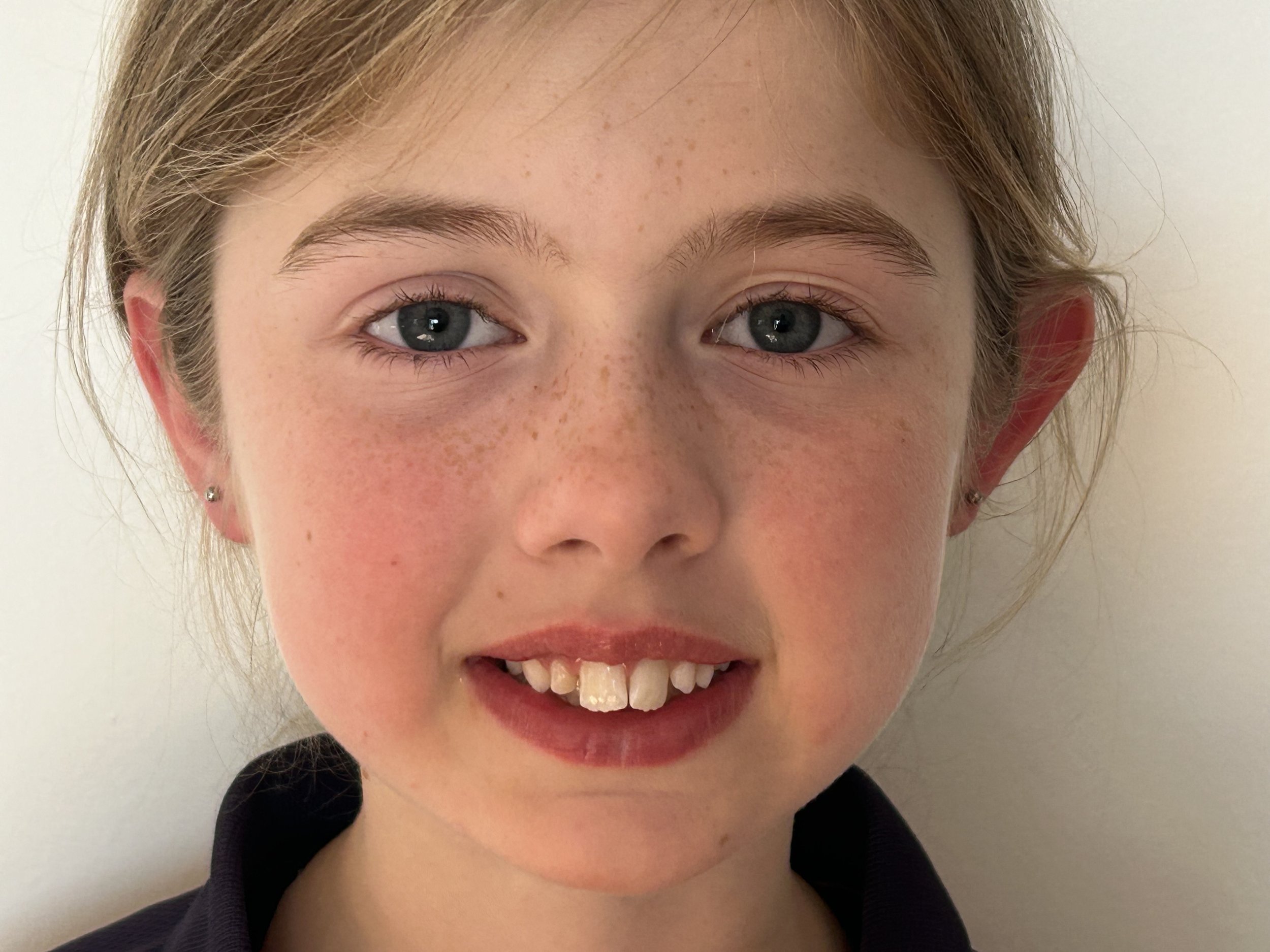 Family friendly kids ear piercing by Chantelle at Laser Luxe and Body Piercing in San Remo, on the Bass Coast