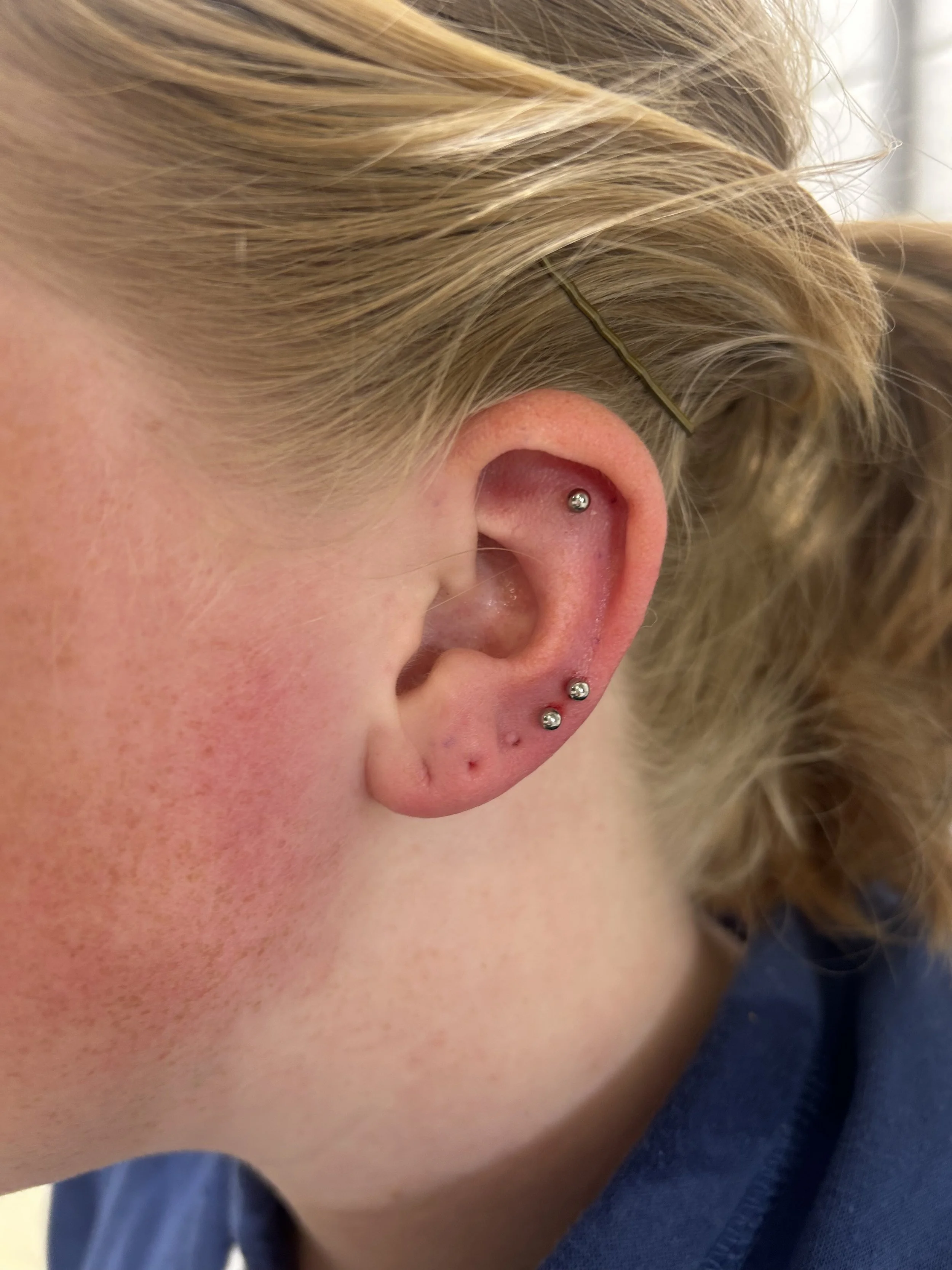 Ear piecing by Chantelle from Laser Luxe and Body Piercing in San Remo, on the Bass Coast