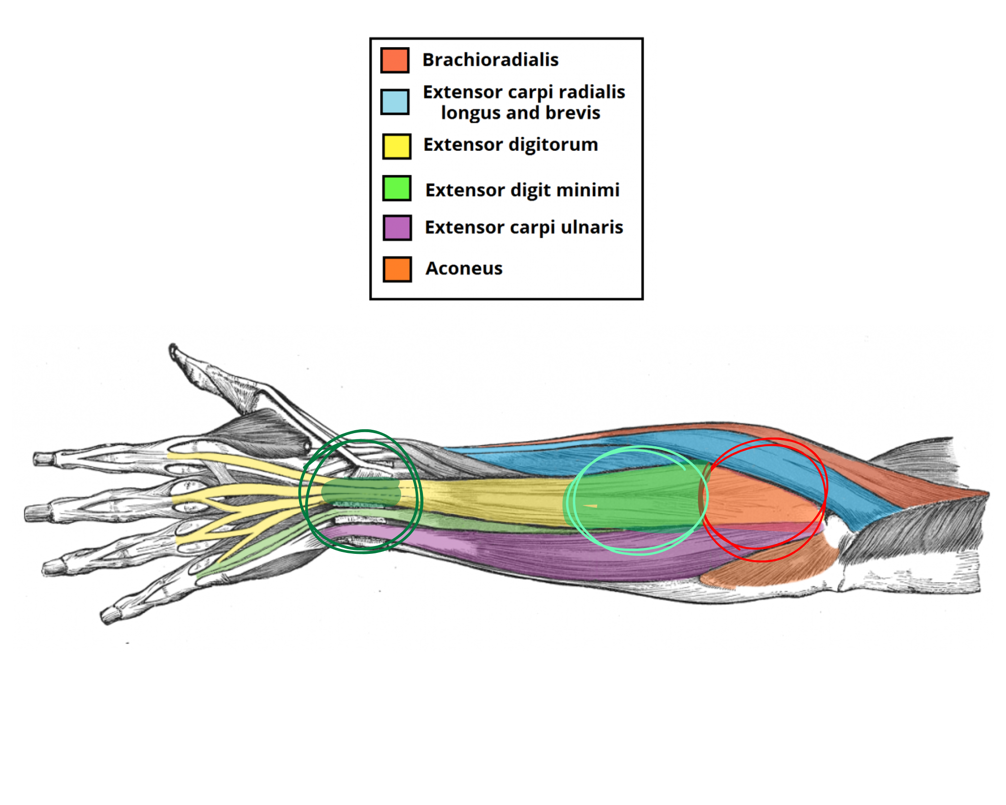 On Injuring the Hand You Use to Do Everything