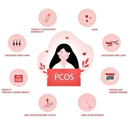 PCOS diagram