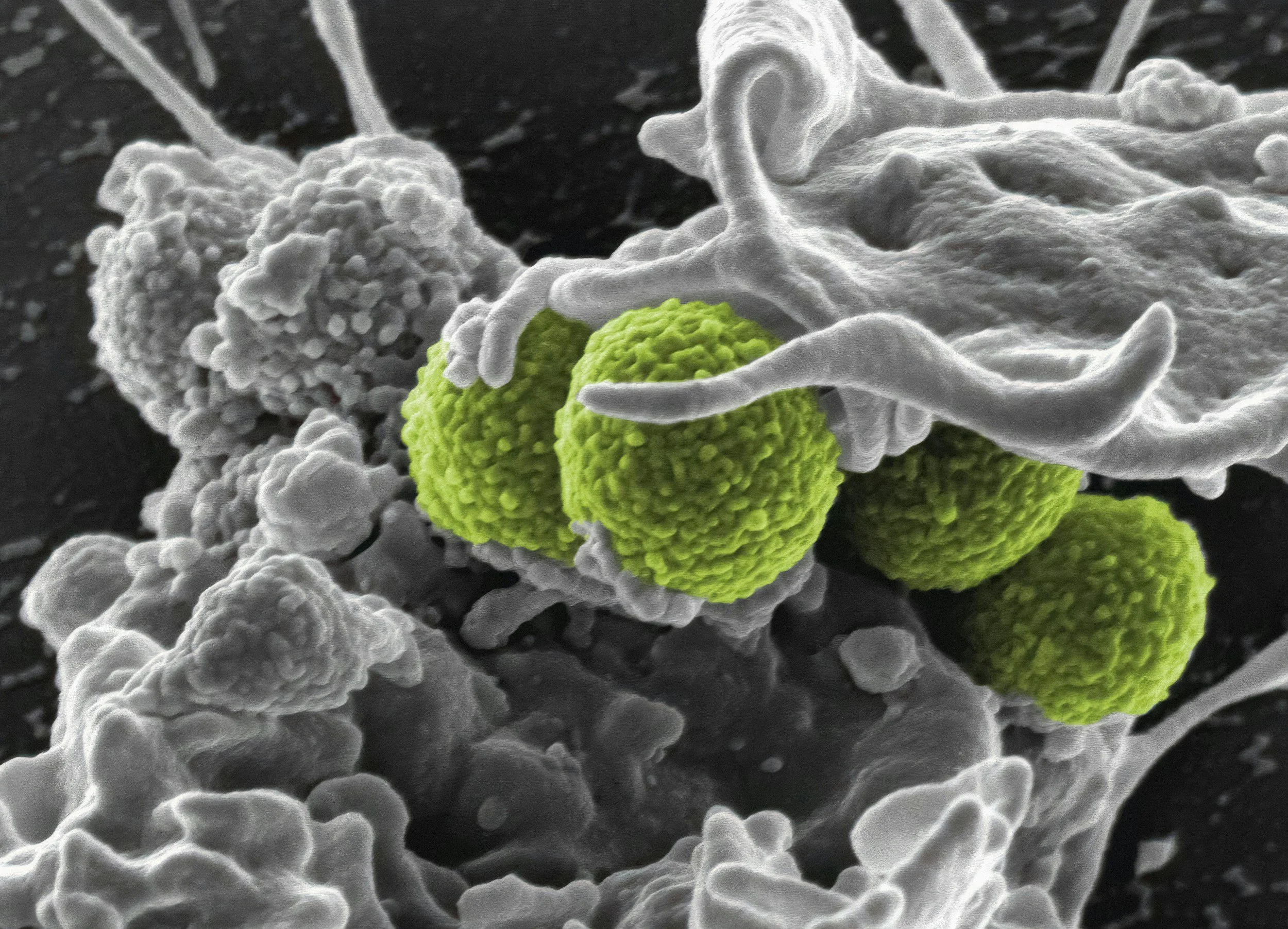Staph bacteria, microbe management and antibiotics&nbsp;