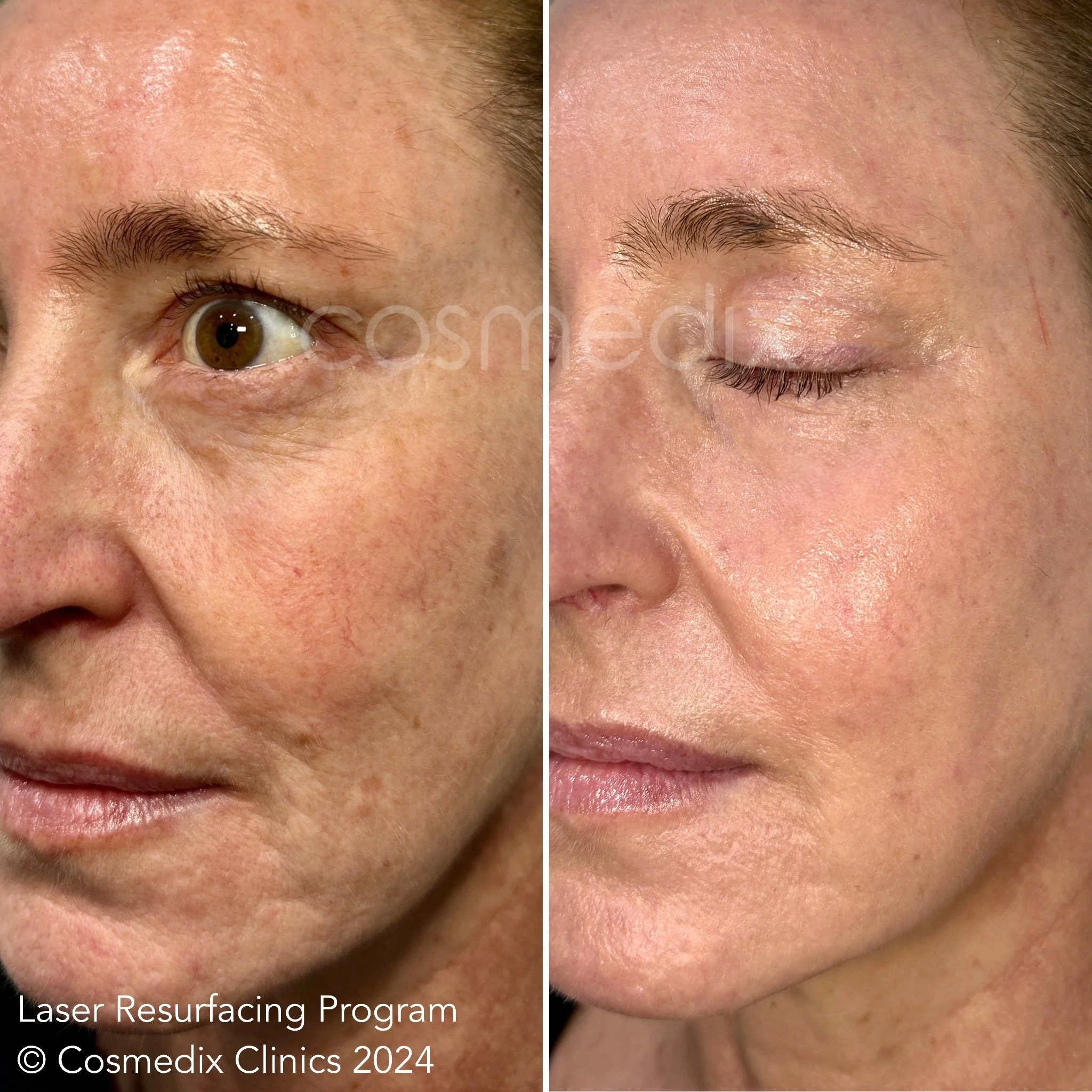 eZy Watermark_04-03-2026_12-41-29-7910am.JPG