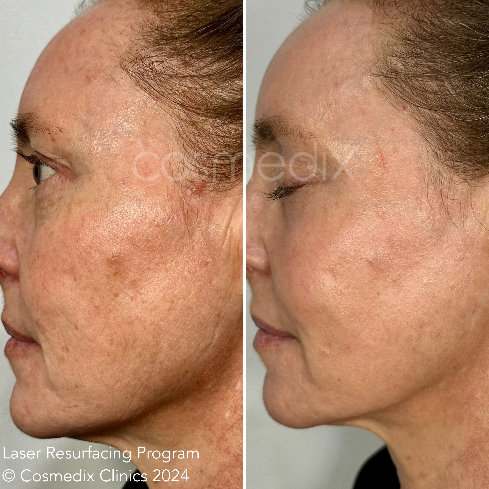 eZy Watermark_04-03-2026_12-43-16-4050am 2.JPG