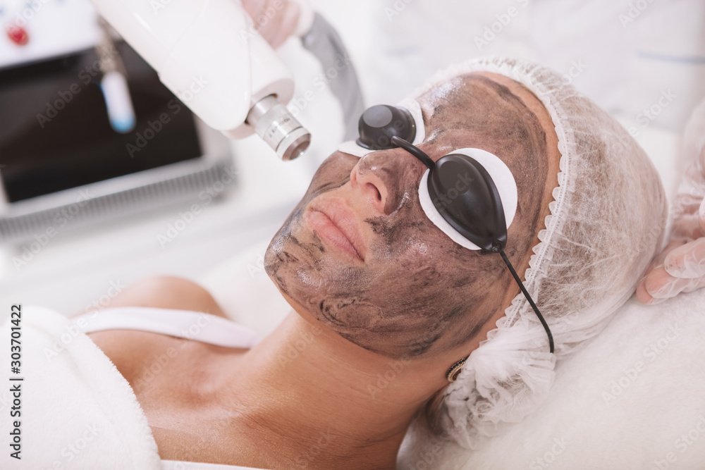 Cosmedix Clinics Carbon Laser Peel - Sydney