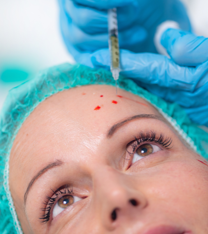 Woman receiving PRP facial injections