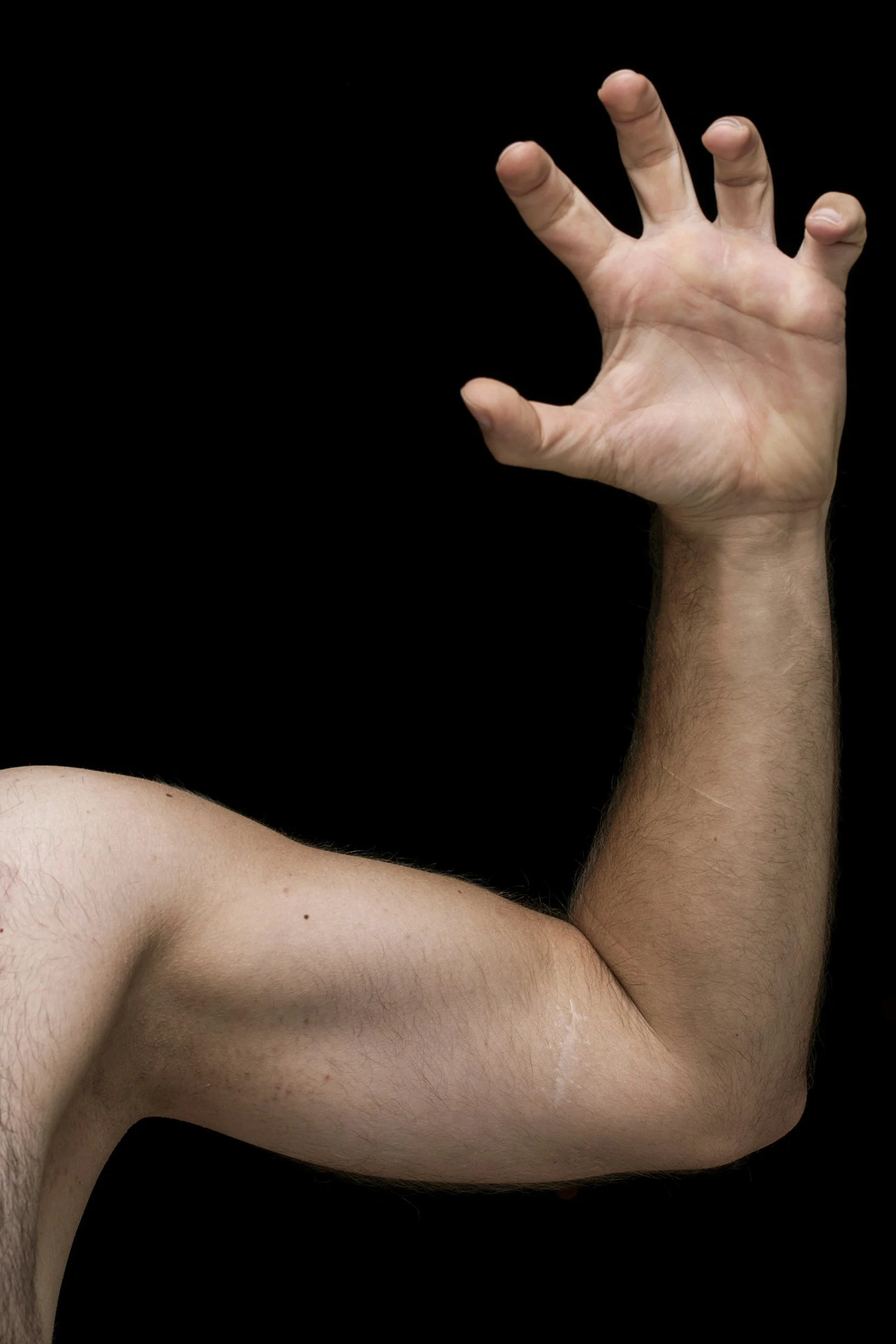 Why Do My Arms Go Numb While Sleeping? Ankeny Iowa Chiropractor