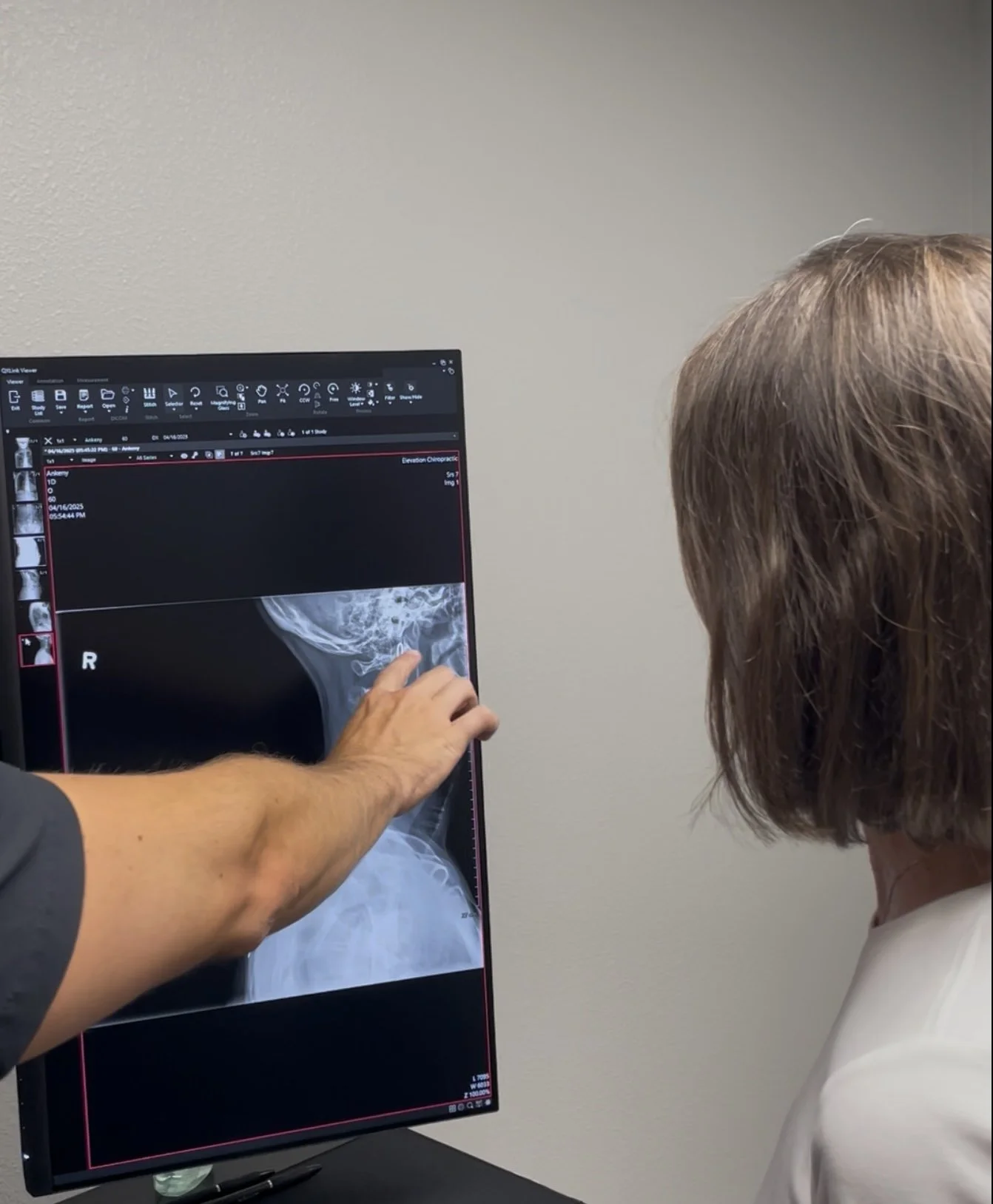 I Turned My Neck, and It Popped—Now It Hurts. What Happened?