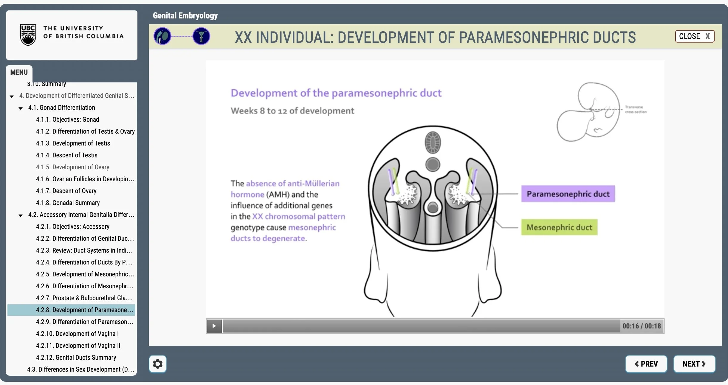 Screenshot of Clinical Anatomy’s e-learning module on the development of the paramesonephric ducts in an XX individual. An illustration of a cross section of an 8 to 12 week embryo and the module’s menu options are displayed.