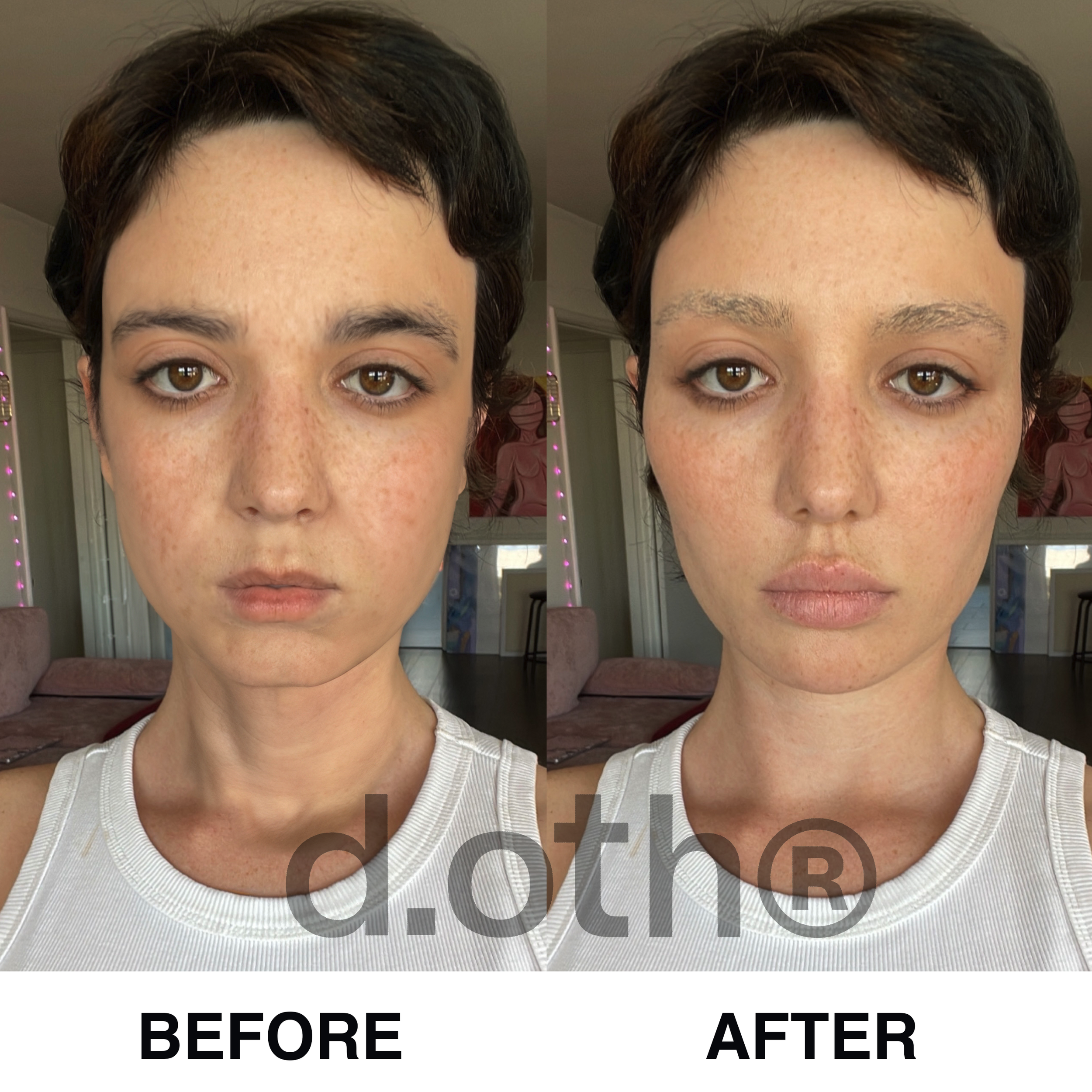 lal before & after.PNG