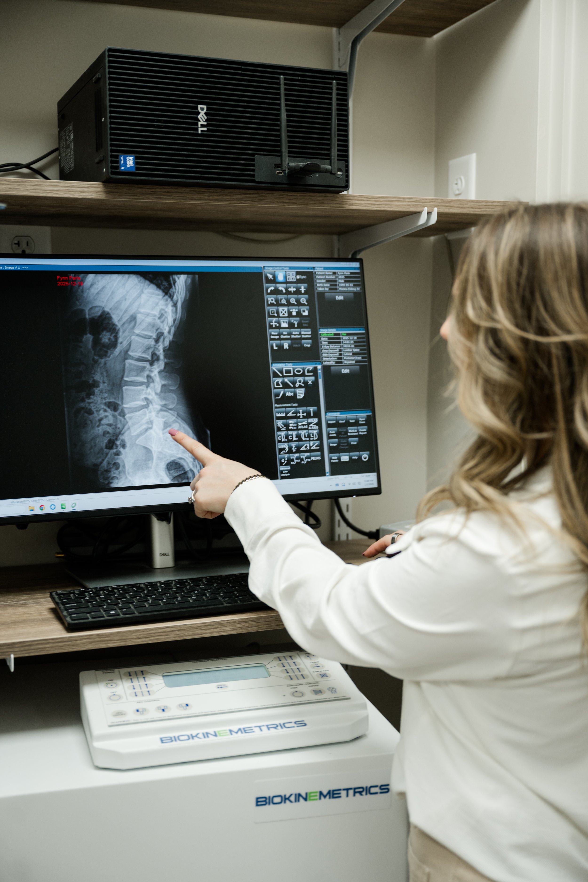 Digital X-Rays at the Chiropractor: Are They Safe and Necessary?