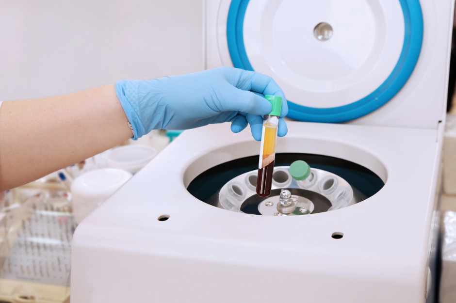 Microneedling with PRP in Lansdale, PA 19446 | Refresh and Renew Aesthetics and Wellness