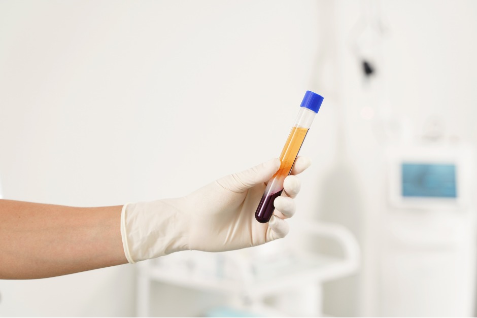 Microneedling in Lansdale, PA 19446 | Refresh and Renew Aesthetics and Wellness