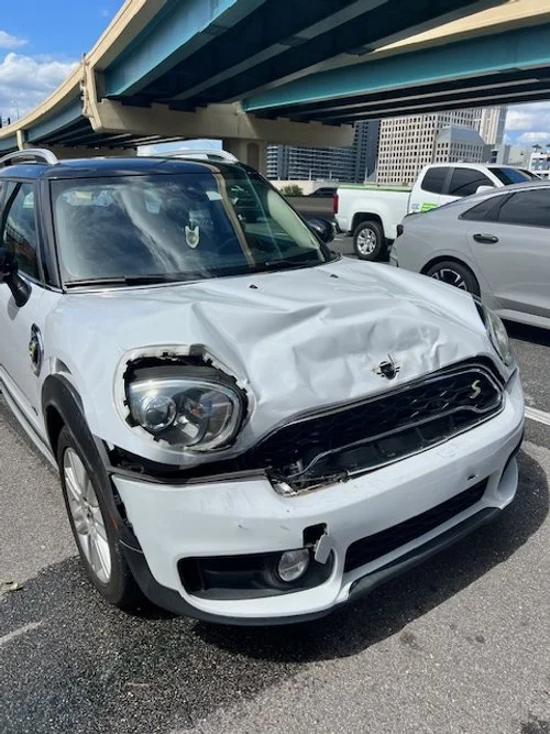 Why You Should Seek Chiropractic Care After a Car Accident