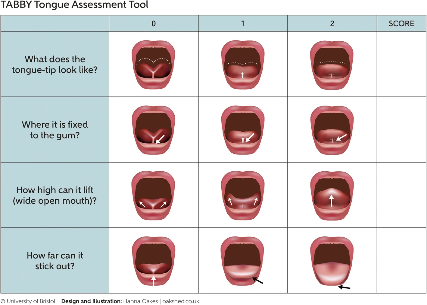 Bodywork &amp; Oral Ties (TOT’s) 