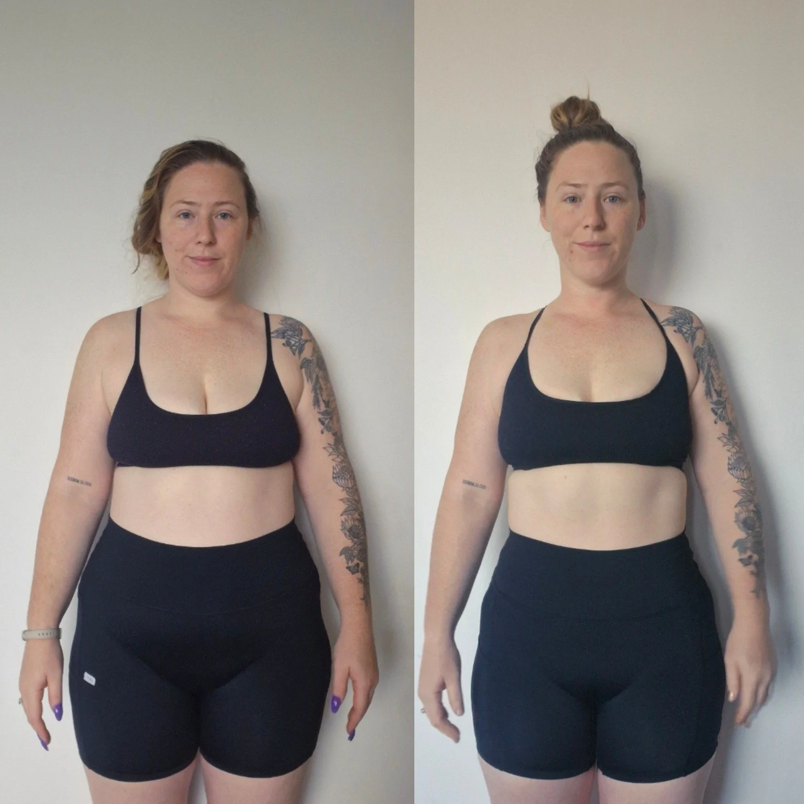 10KGS GONE