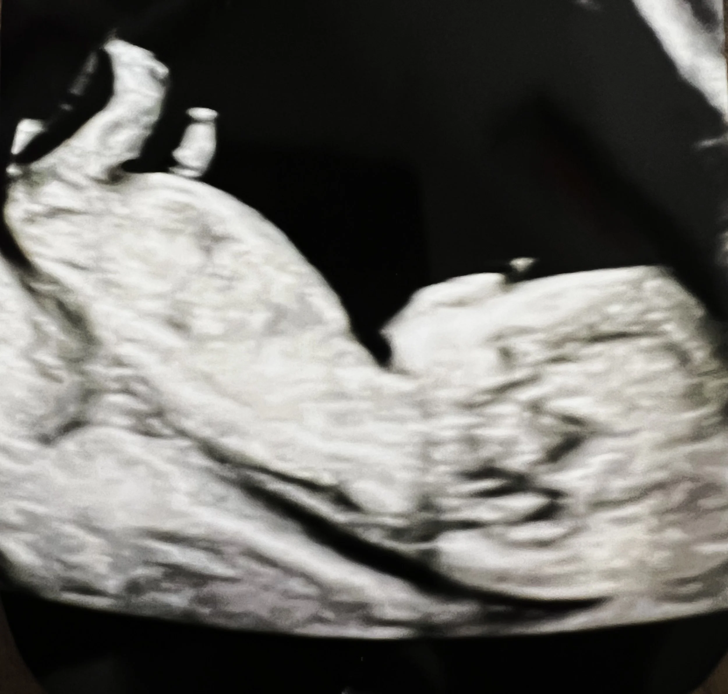 10-13 weeks ultrasound.jpeg