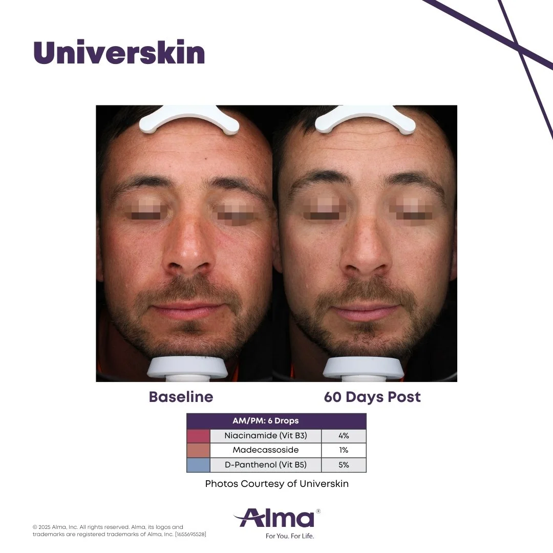 Before and after images serum mix