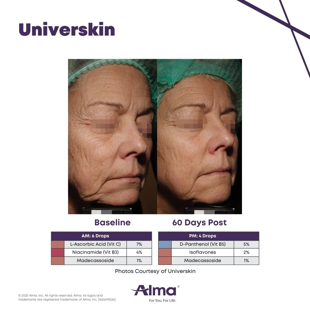 Before and after image serum mix 