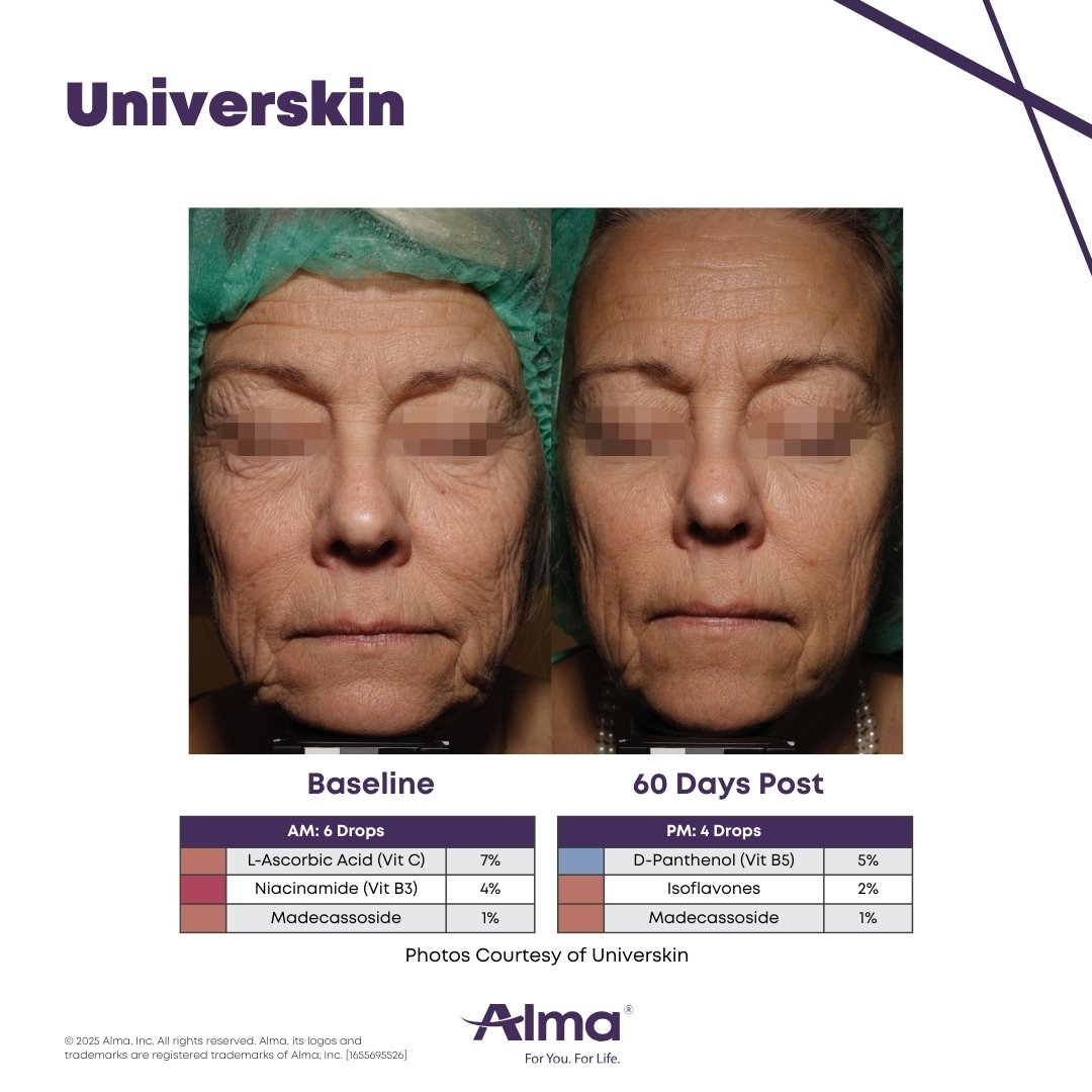 Universkin Before and after 