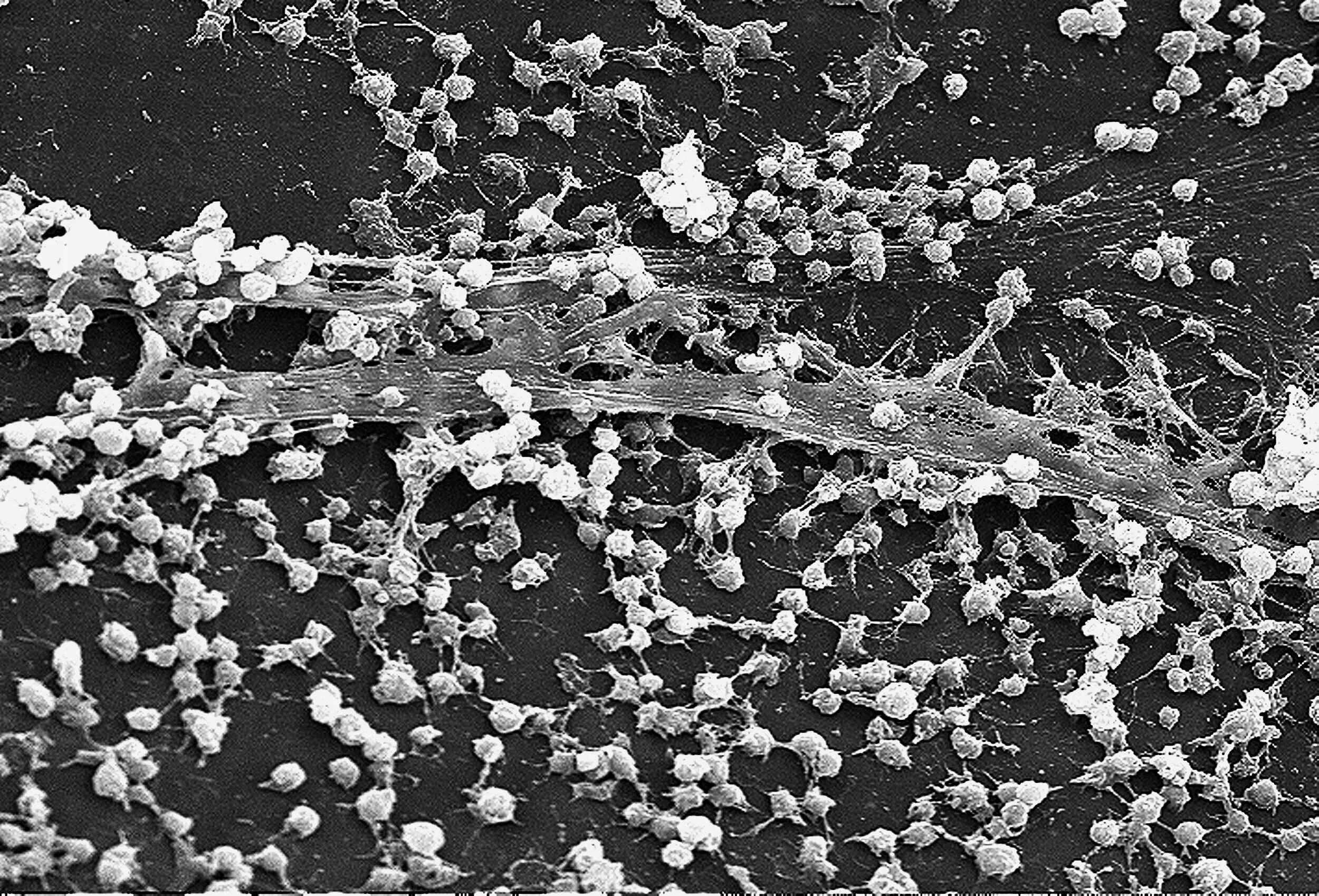 Biofilms as the Culprit for Chronic, Resistant Infections?