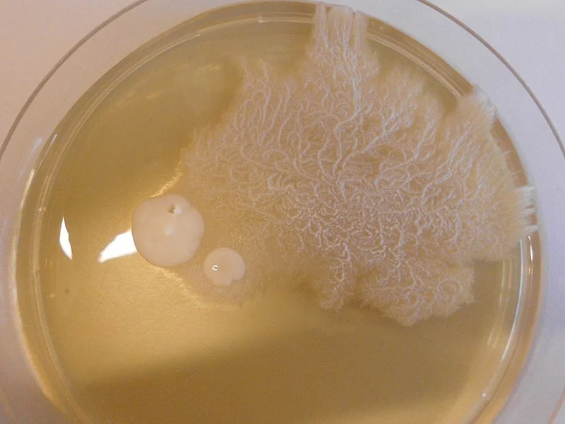 Does invasive candida play a role in chronic illness? The answer is YES!