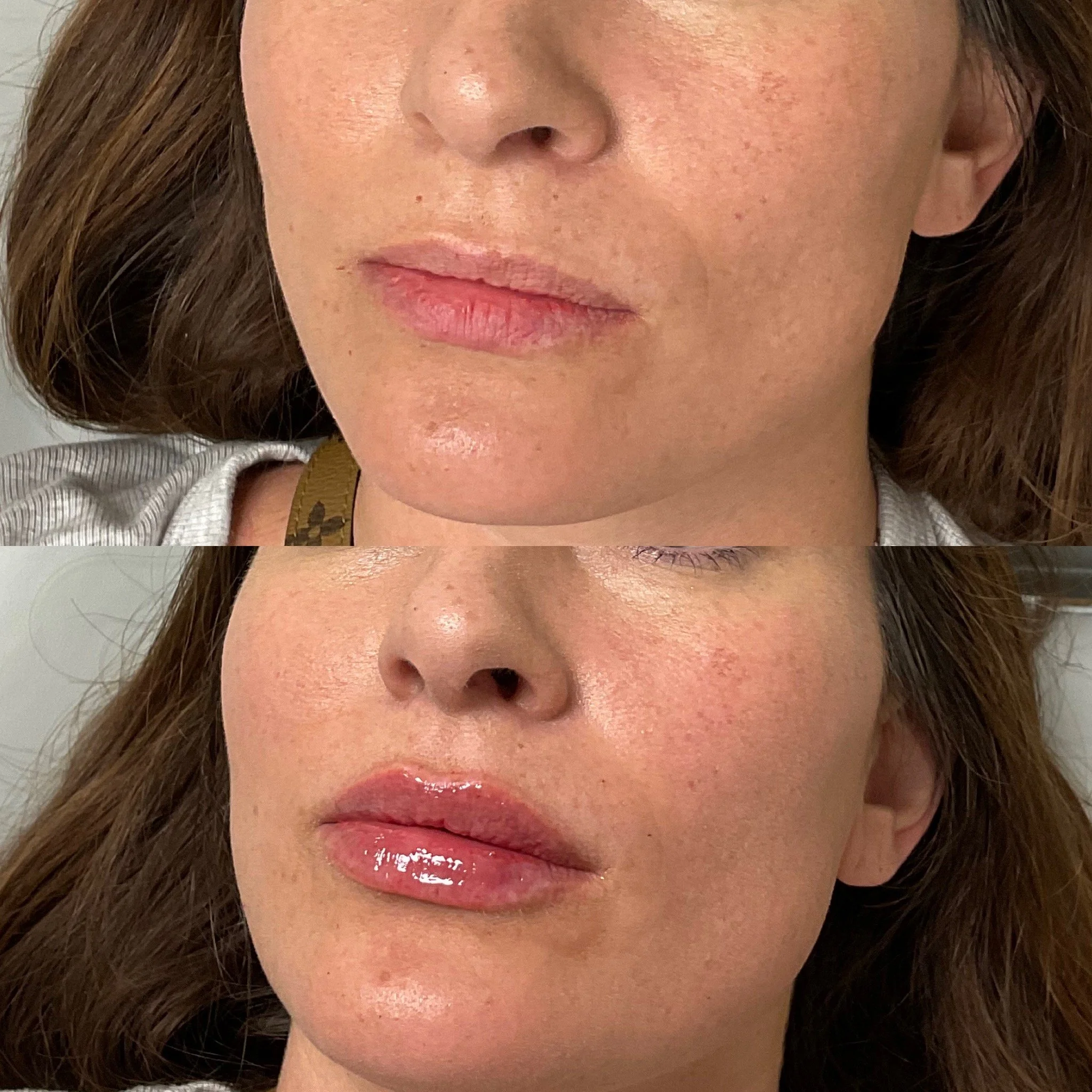 Close-up of a woman's face, showing her lips with glossy lipstick, nose, and a portion of her cheek and hair.