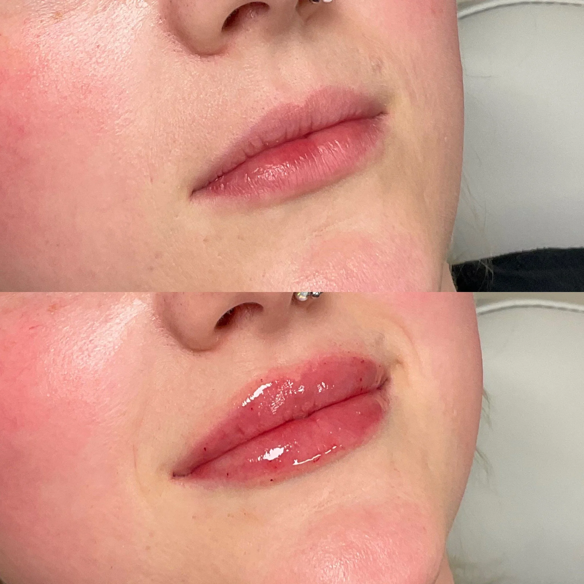 Close-up of a person's lips with glossy lipstick, and facial skin with visible pores and a nose piercing.