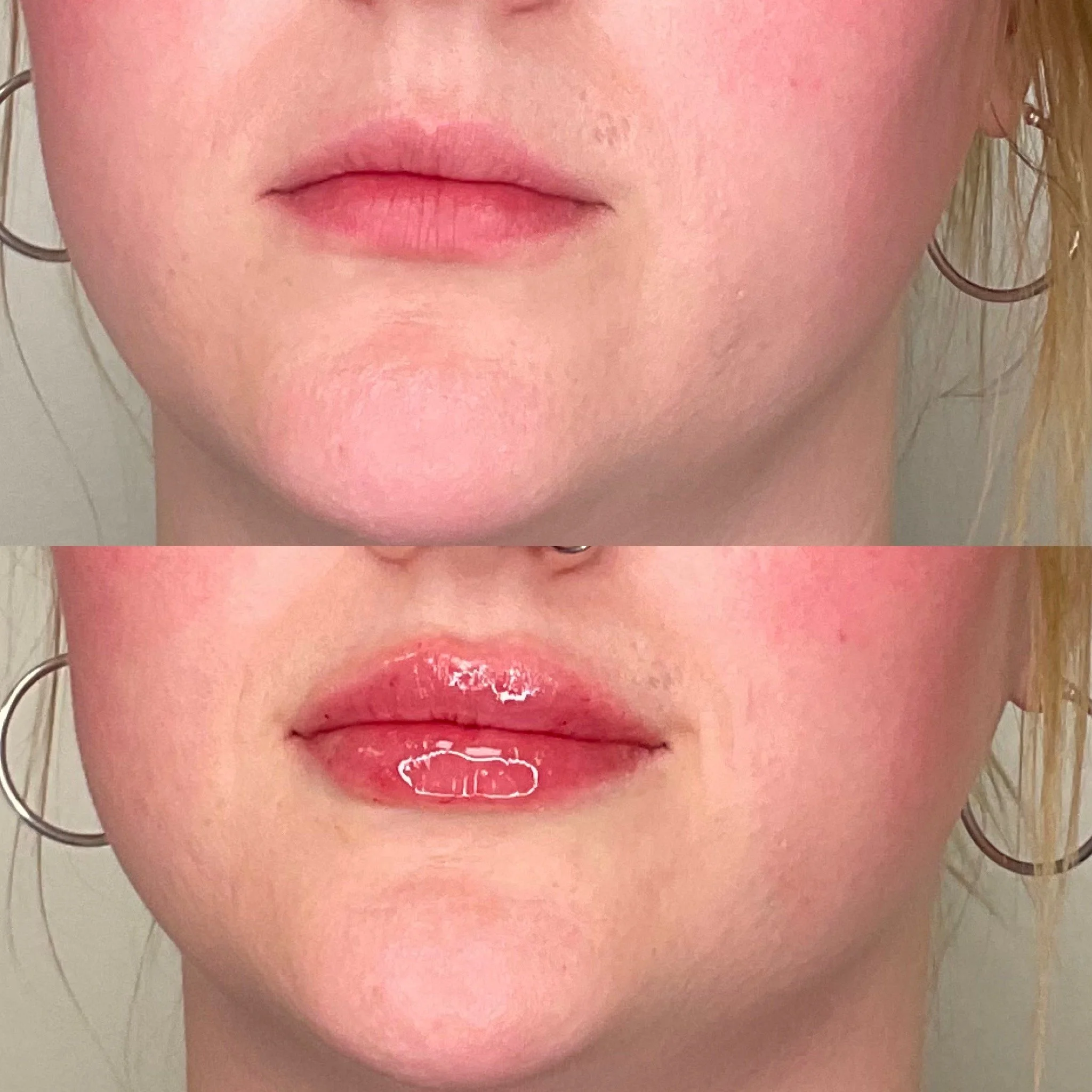 Close-up of a person's lower face with lips slightly parted, showing a tongue ring, and earrings visible on the side.