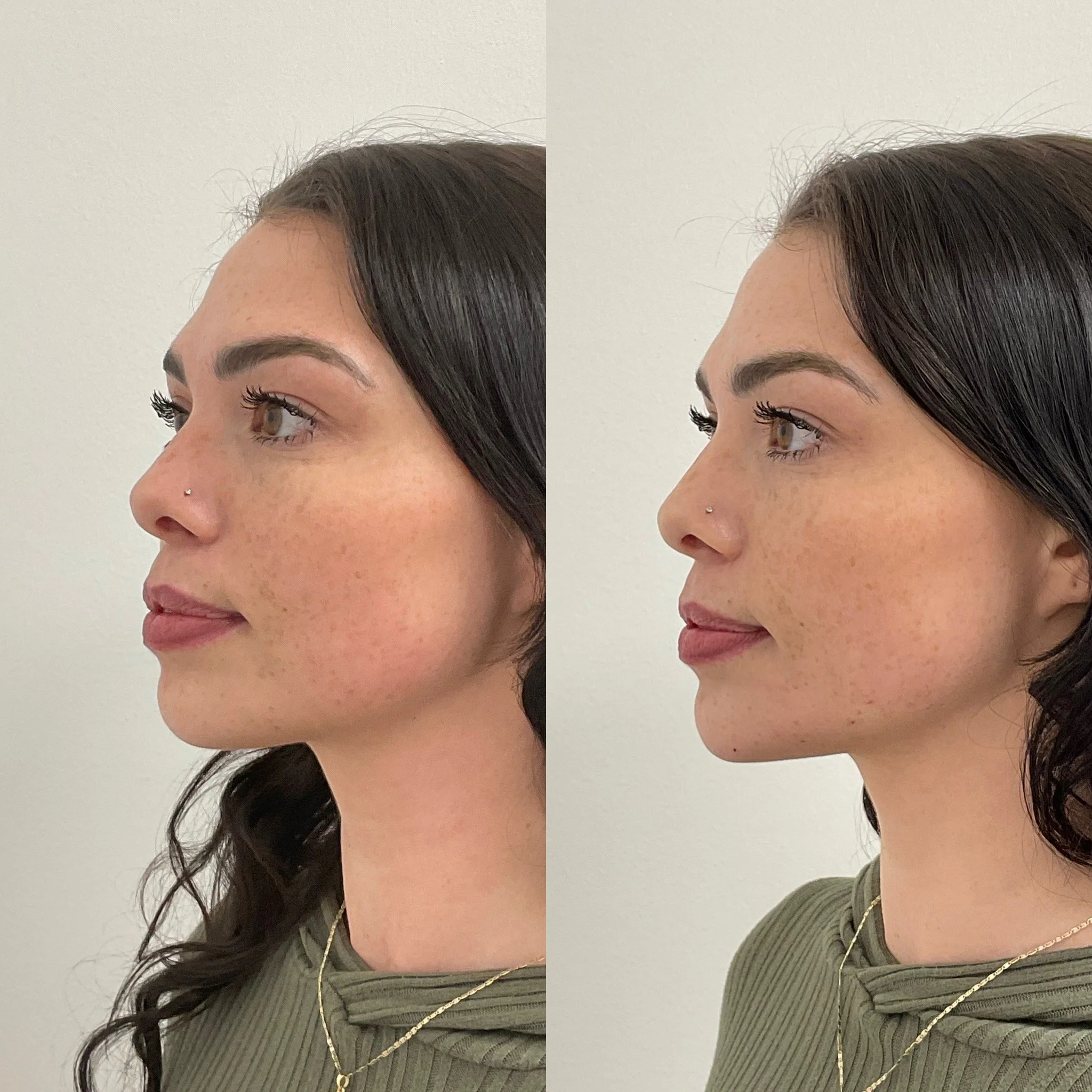 Comparison of two side profiles of a woman with dark hair, wearing a green top and gold necklaces, and a nose piercing, against a plain light background.