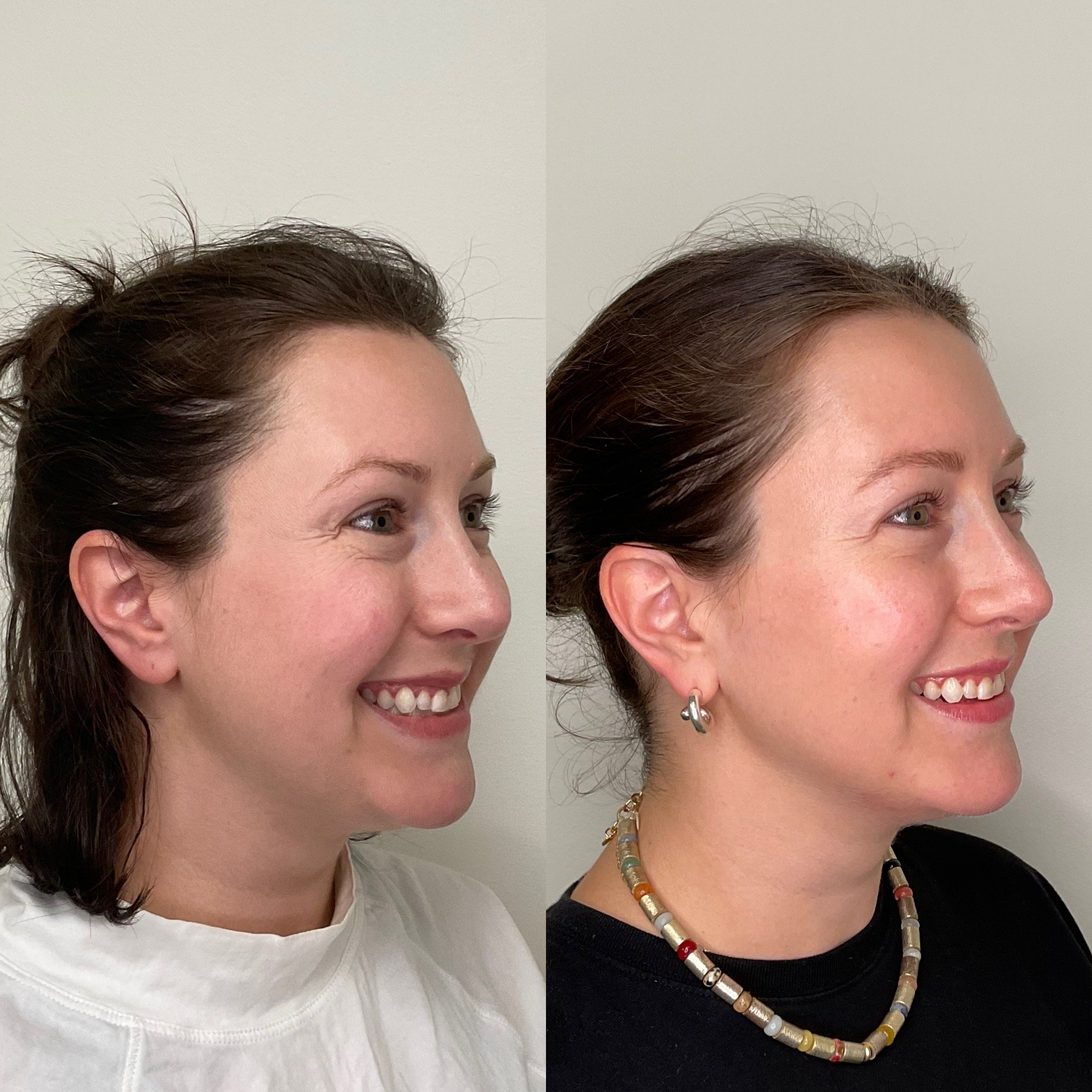 Close-up of two women smiling and facing each other, showing only the top halves of their faces and heads, with one in a white shirt and the other in a black shirt, both wearing necklaces, with a plain light-colored background.