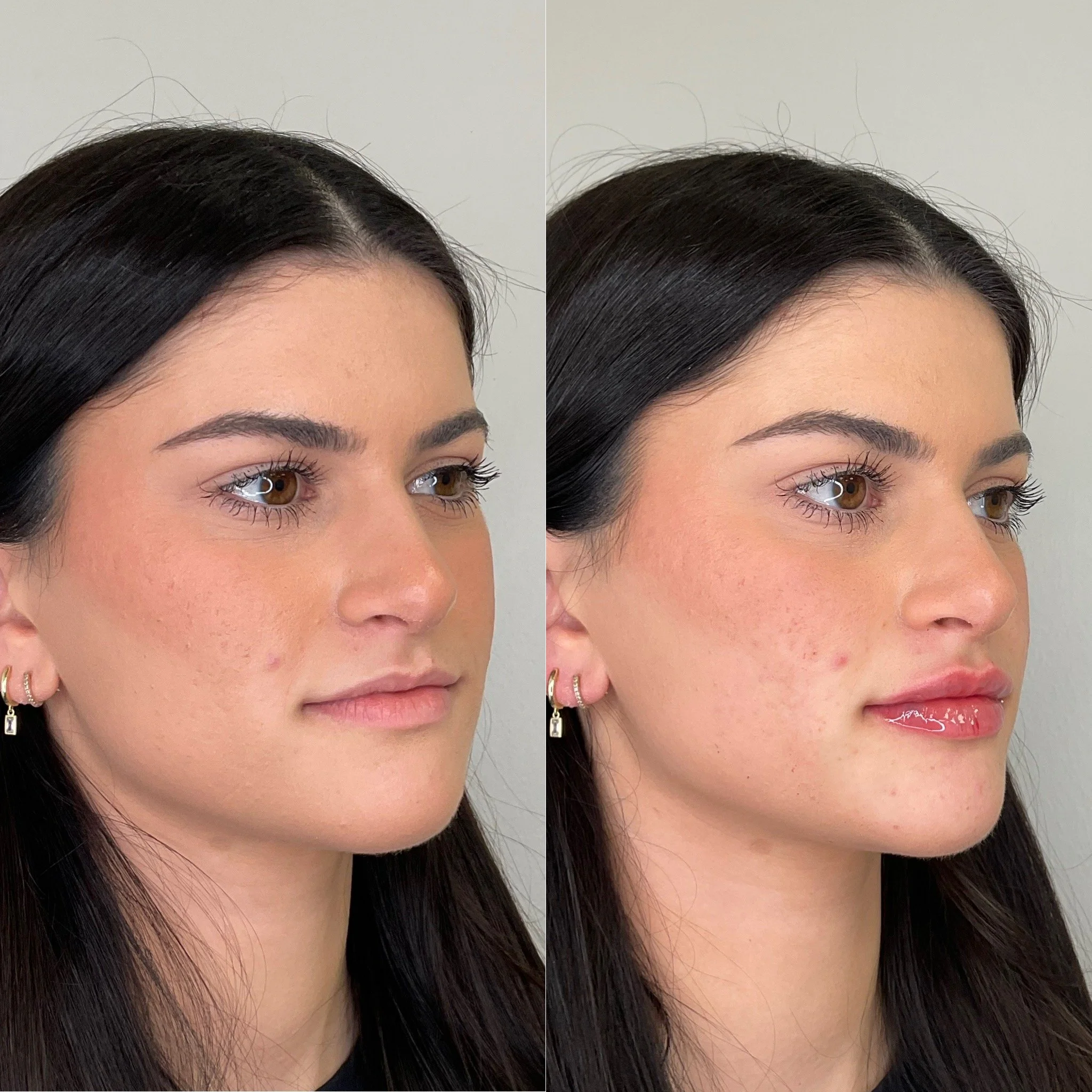 A side-by-side comparison of a woman's hair before and after a hair treatment, focusing on the top of her head with dark brown or black straight hair and her face partially visible.