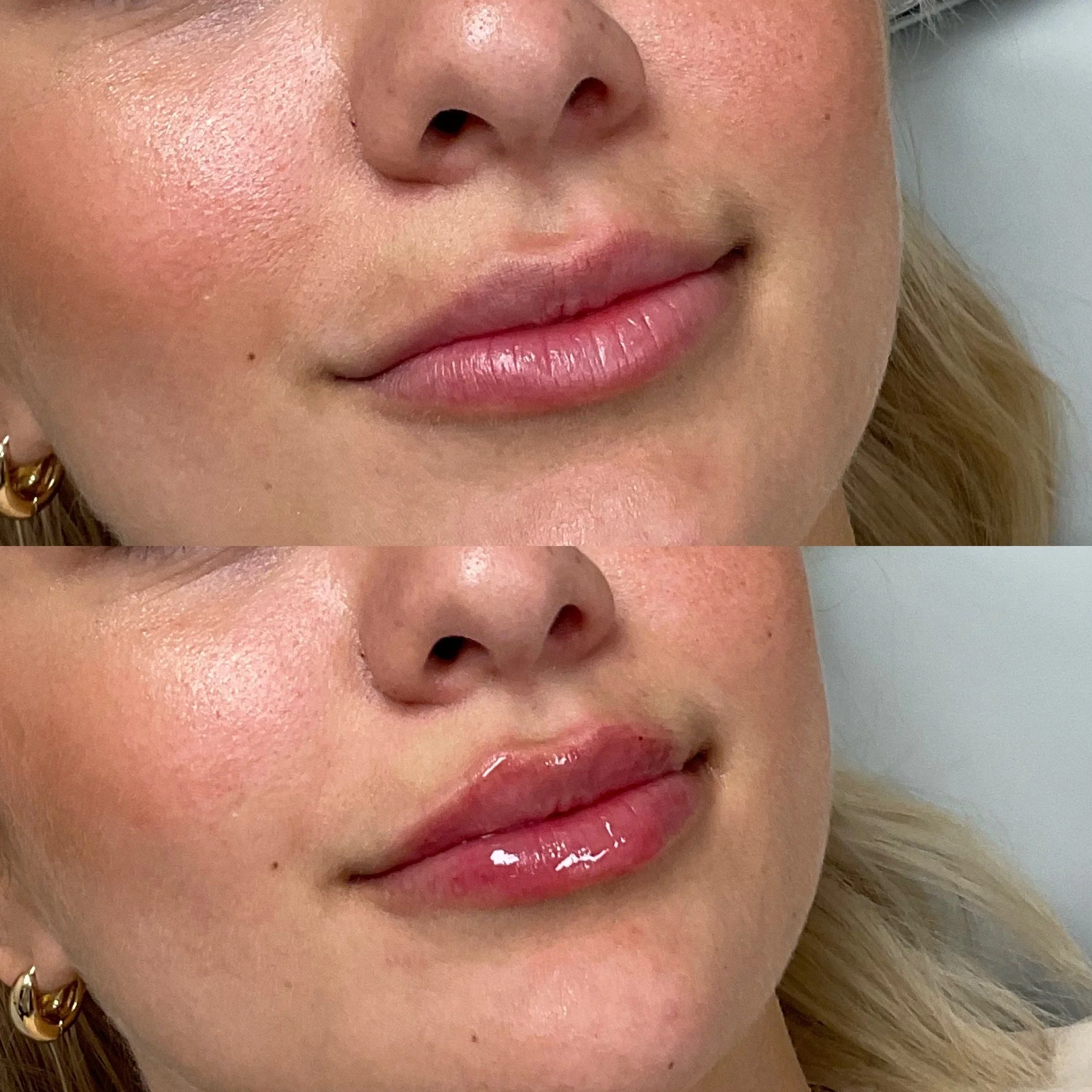 Close-up of a woman's face showing her lips, nose, and part of her cheek with natural skin texture and makeup.