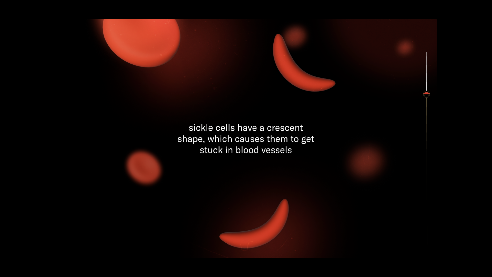 SickleBall_Awards.009.png