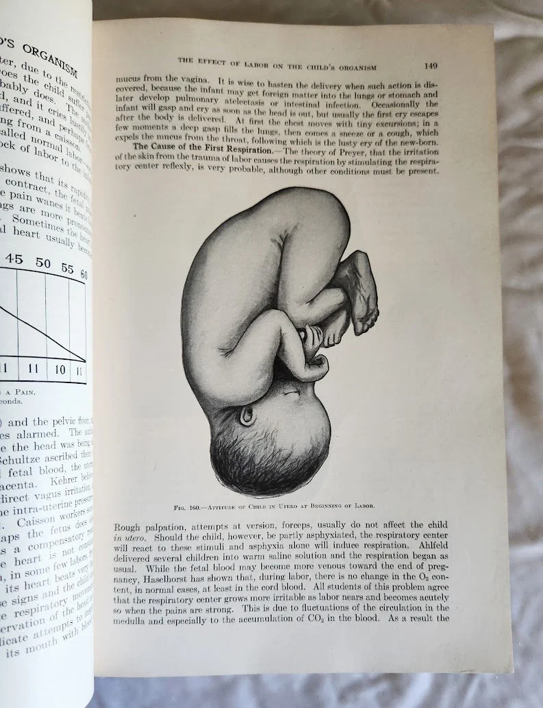 DeLee Principles & Practice of Obstetrics 10.jpg