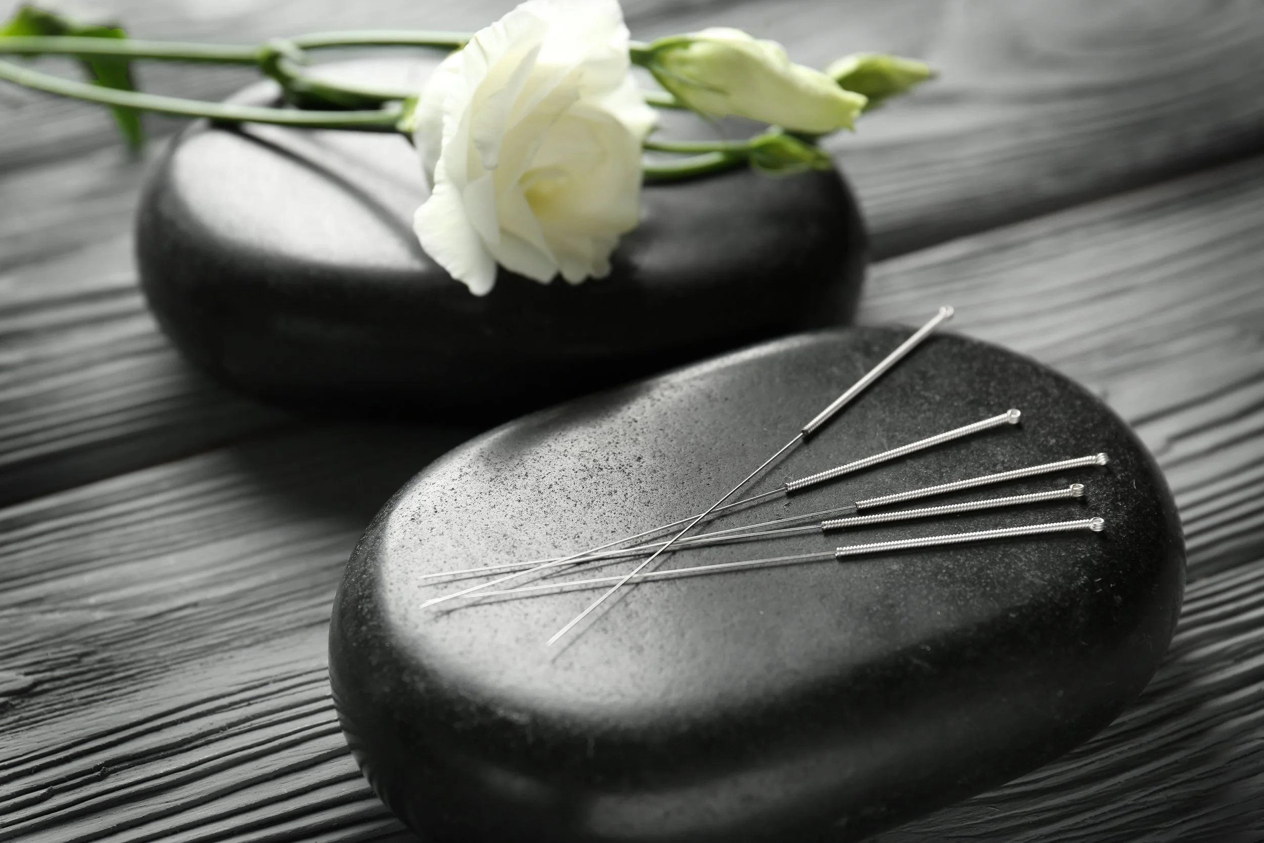 Chronic Headaches and Migraines: Can a Natural Approach Like Acupuncture Help?