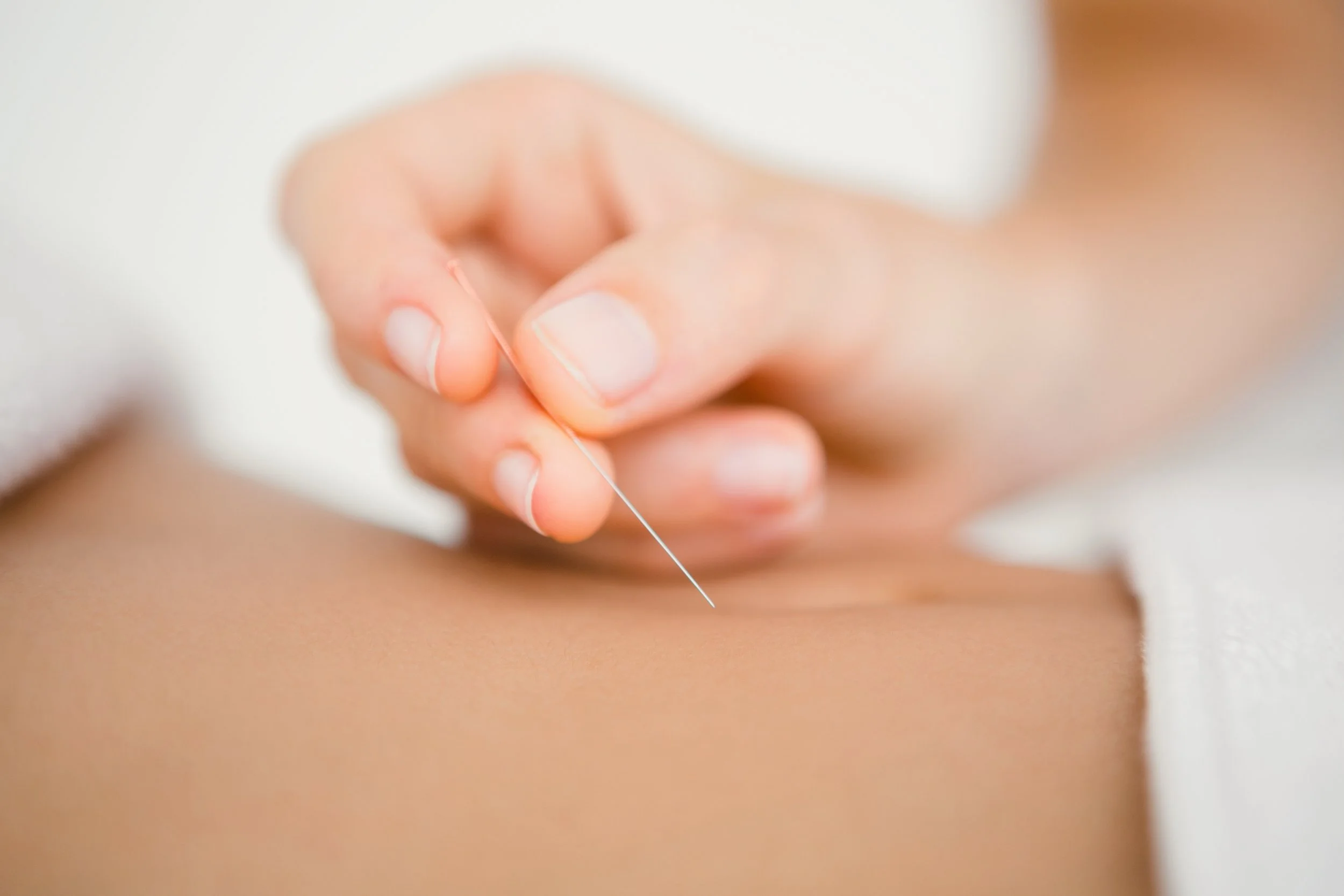 Benefits of Acupuncture: 7 Health Benefits You Should Know