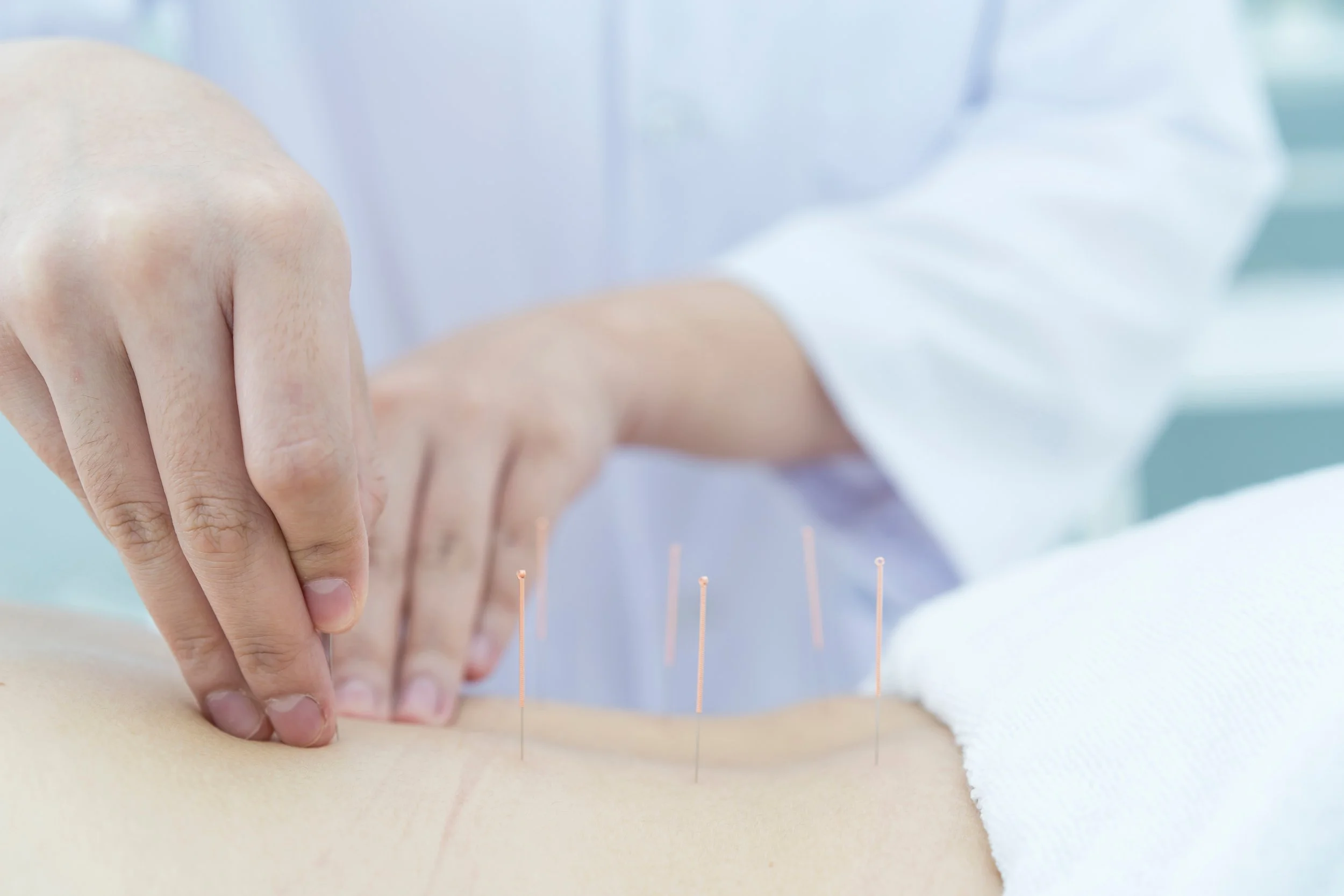 Low Back Acupuncture